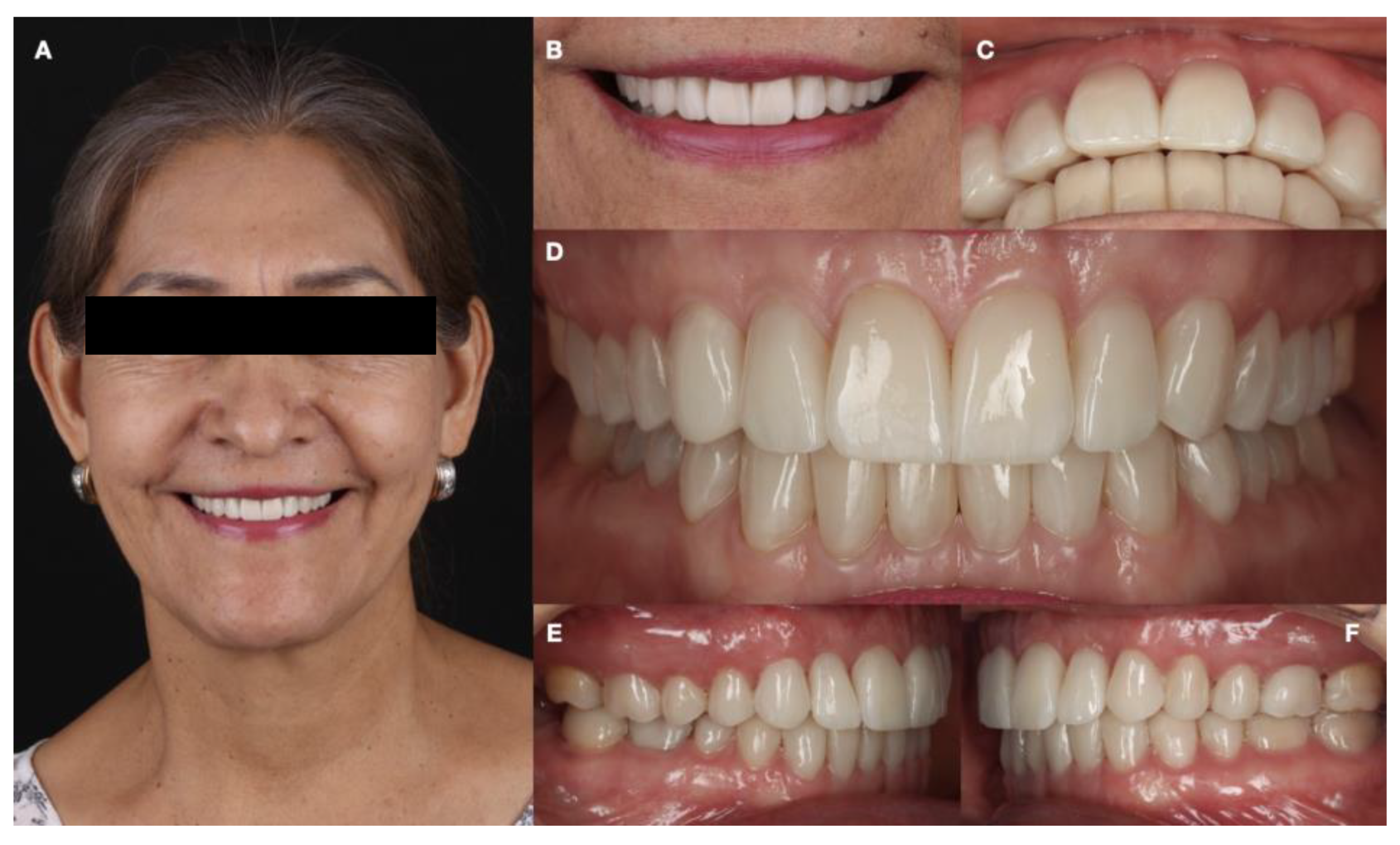 Dentistry 12 00218 g014