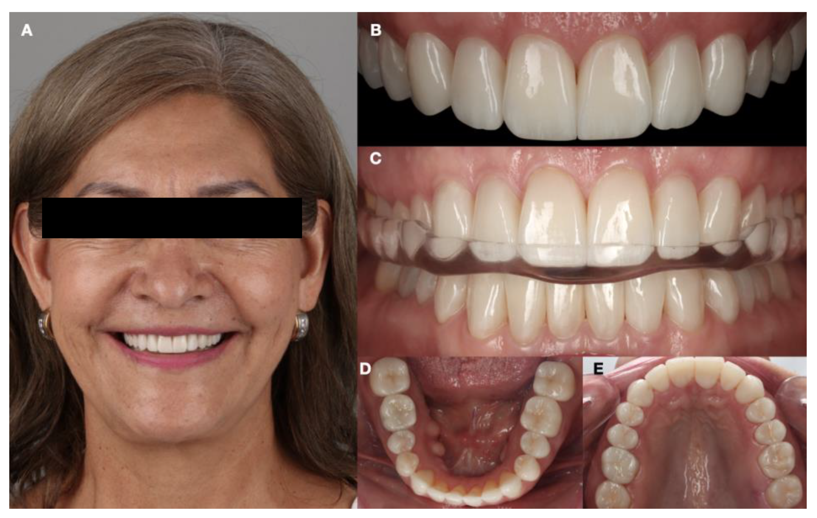 Dentistry 12 00218 g015