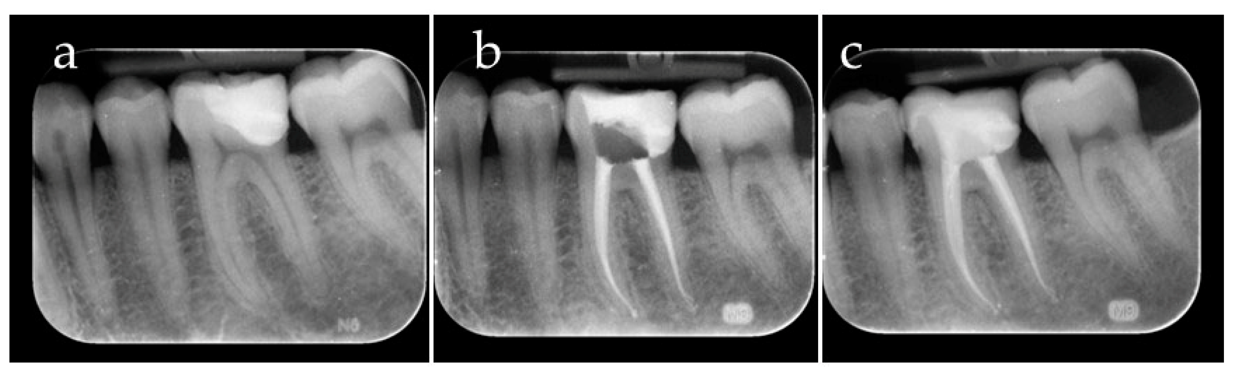 Dentistry 12 00239 g008