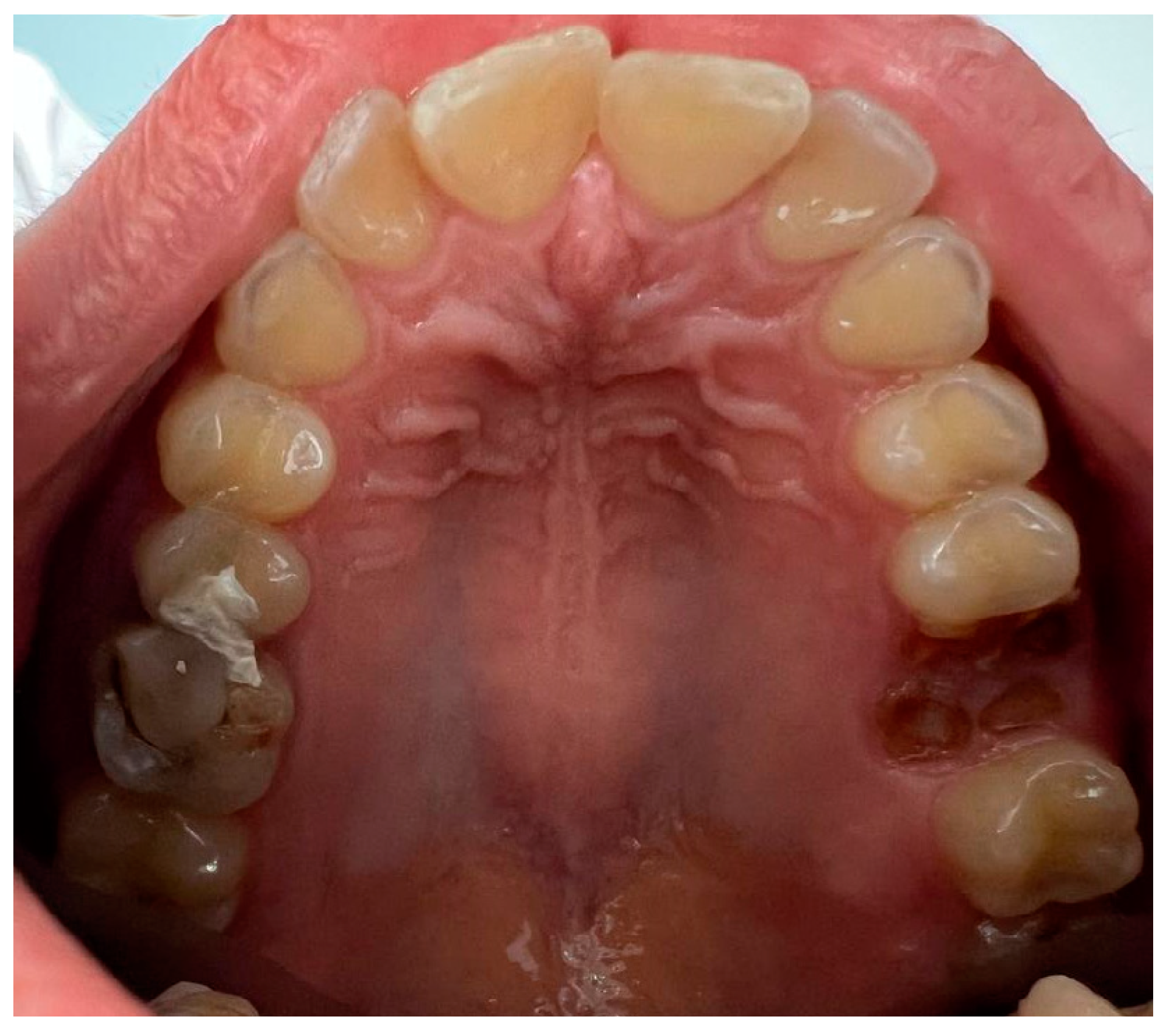 Dentistry 12 00242 g001 Dentistry 12 00242 g001
