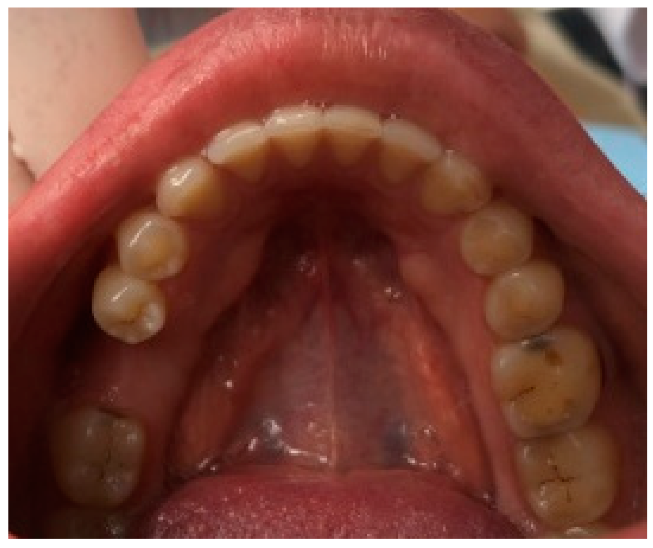 Dentistry 12 00242 g002 Dentistry 12 00242 g002