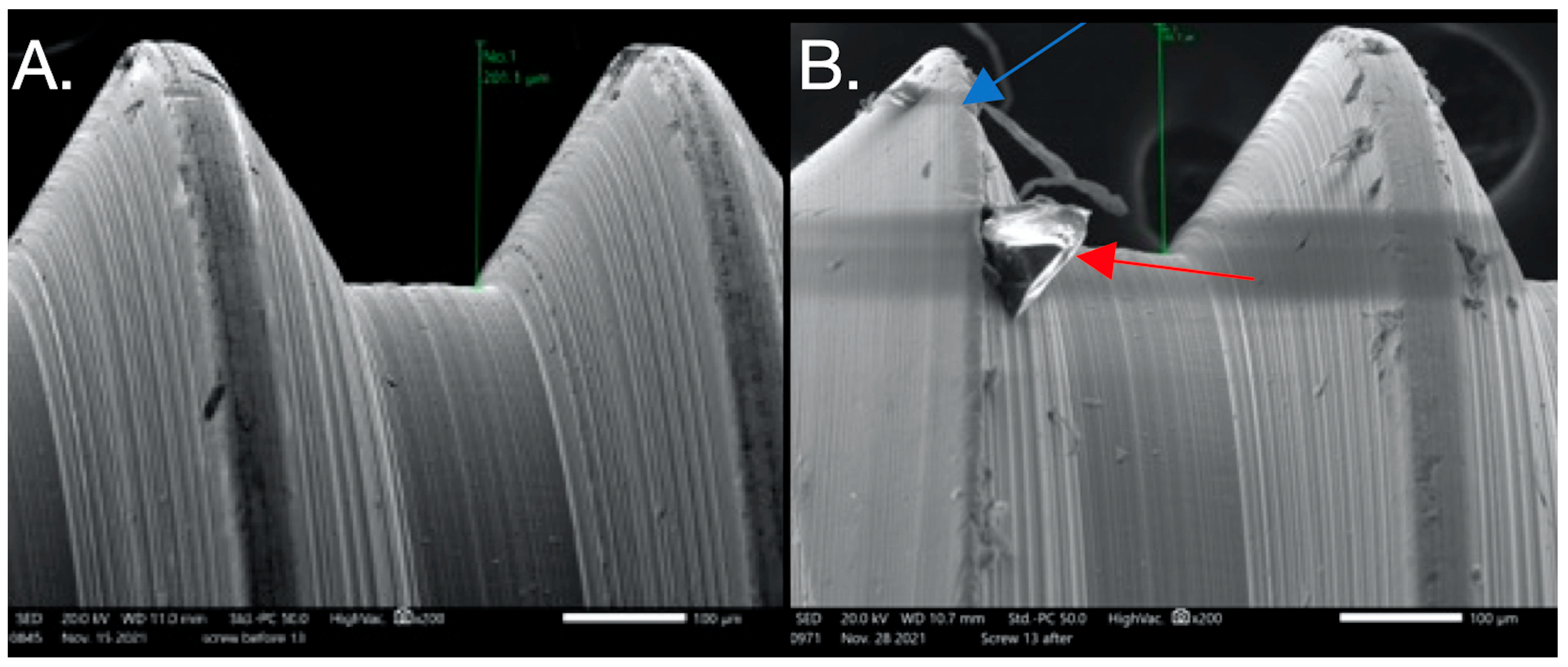 Dentistry 12 00265 g005