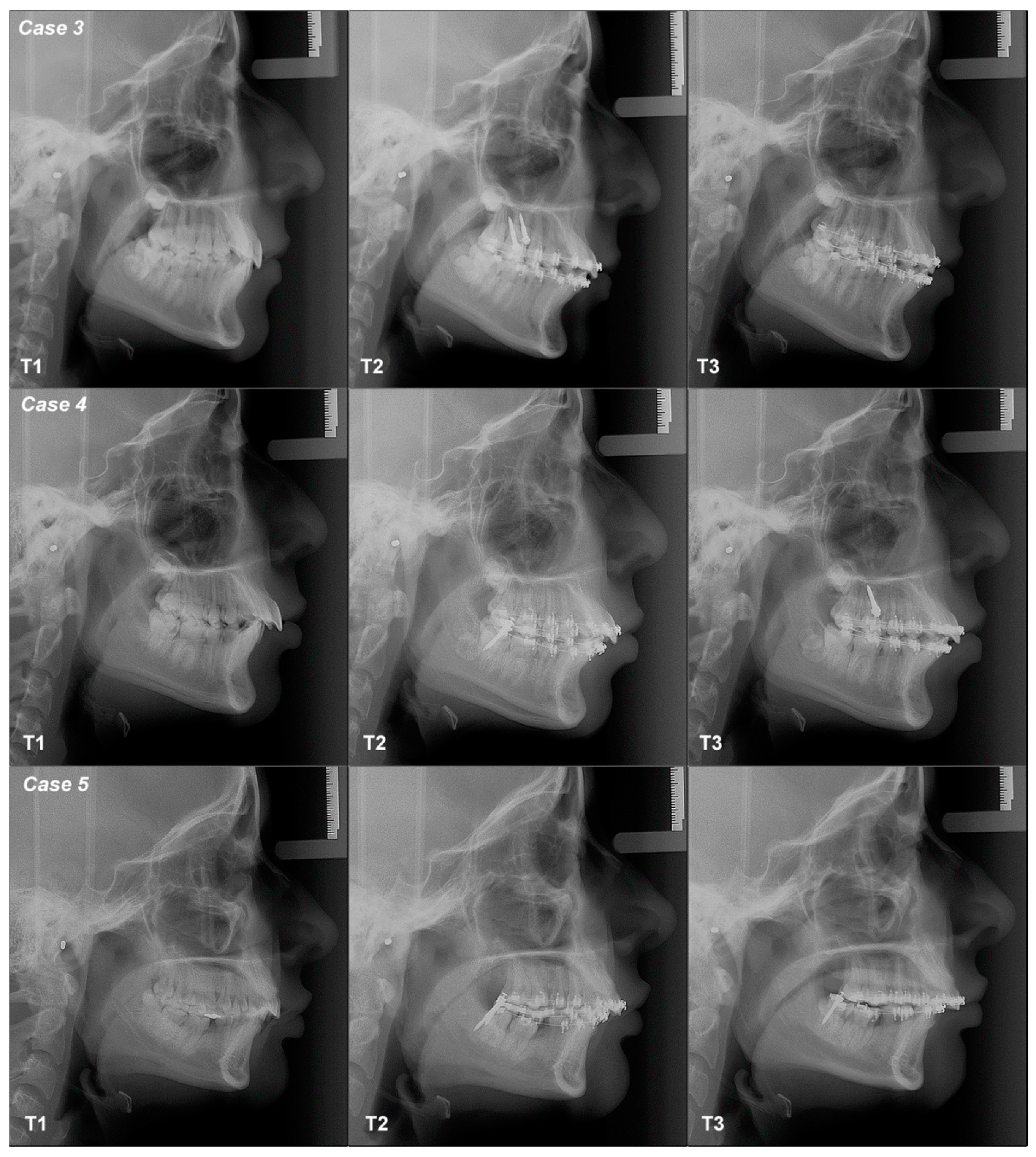 Dentistry 12 00278 g006