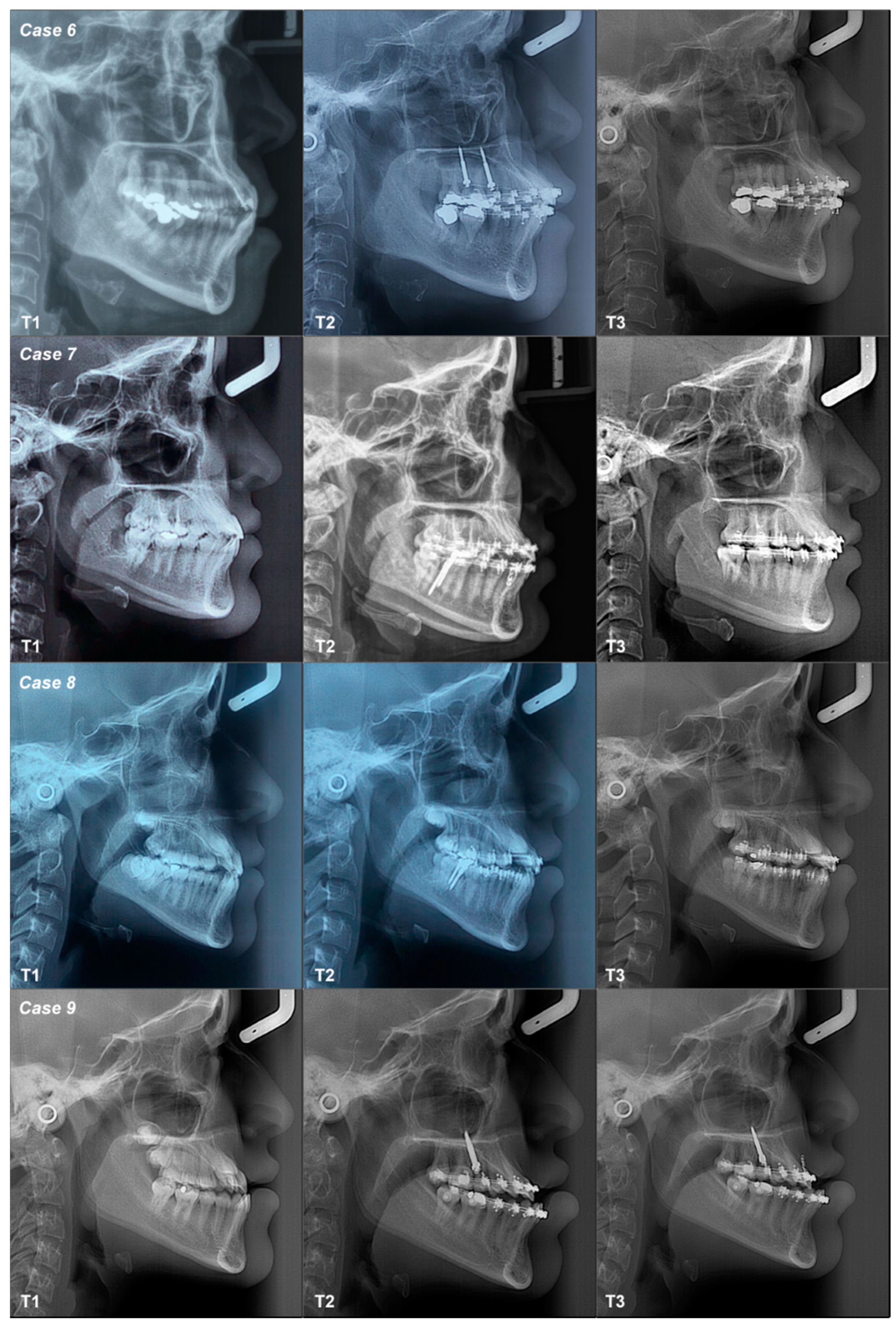 Dentistry 12 00278 g007