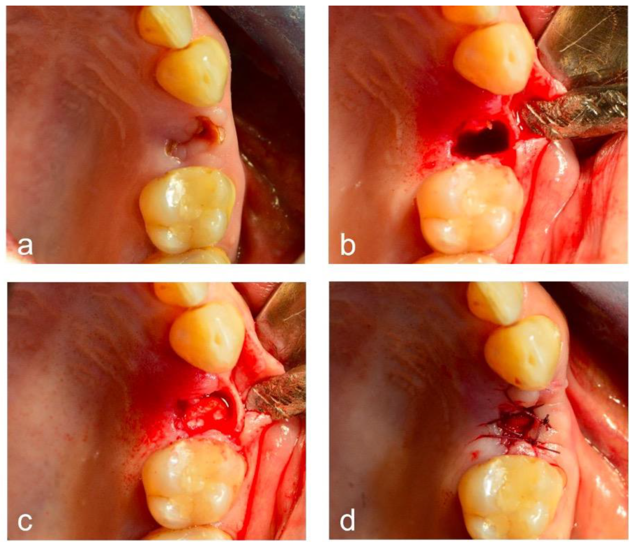 Dentistry 12 00279 g002