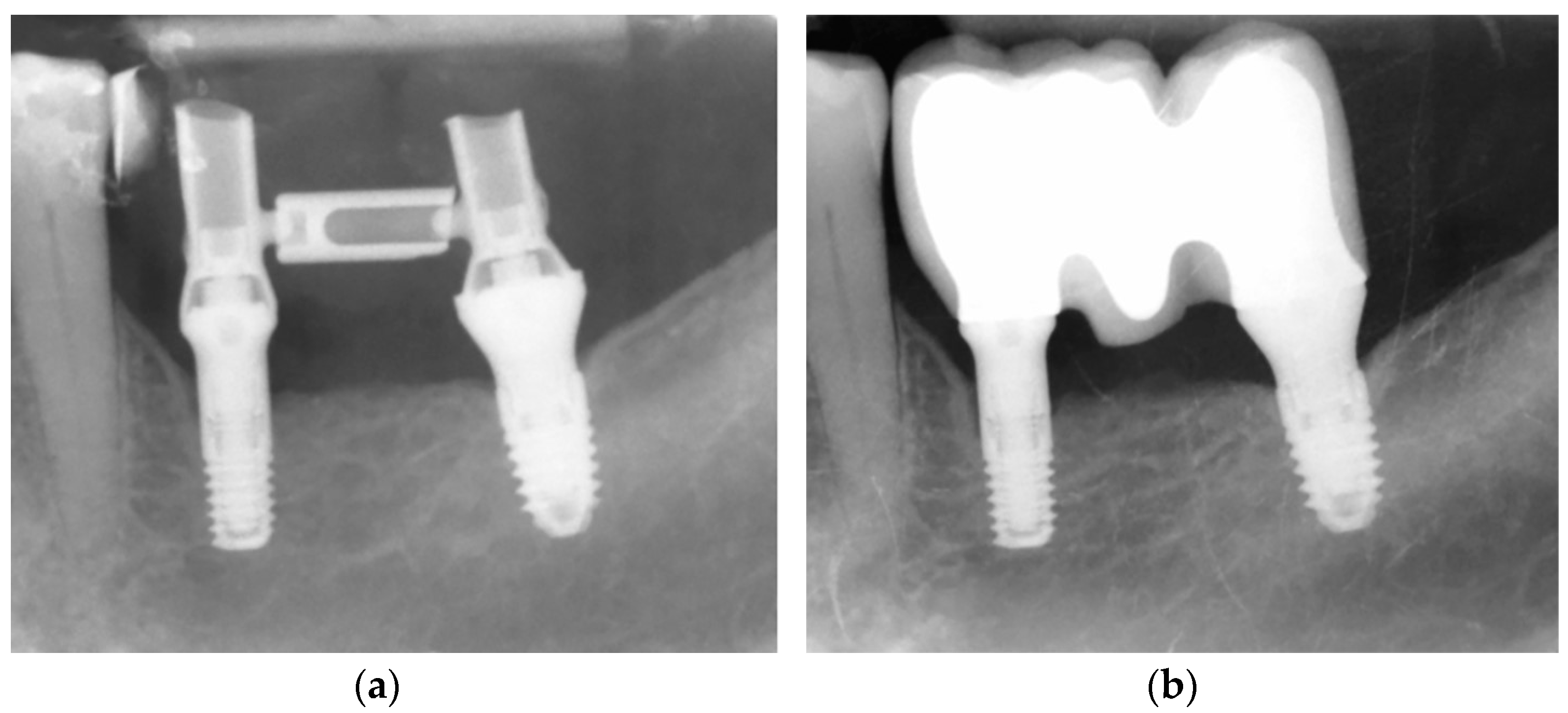 Dentistry 12 00292 g003