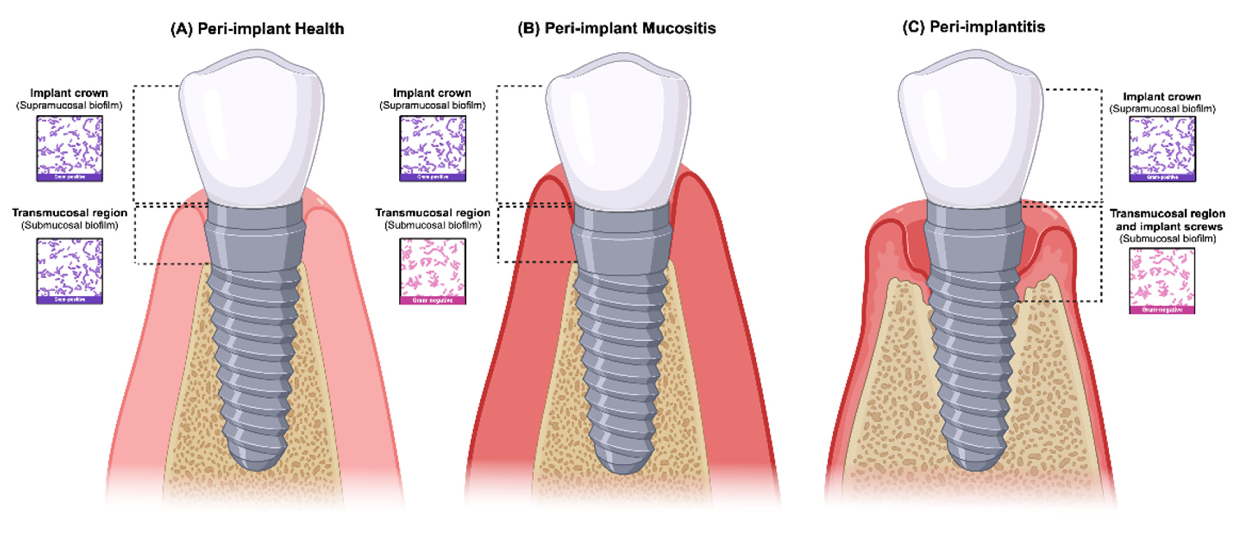 Dentistry 12 00299 g001 Dentistry 12 00299 g001