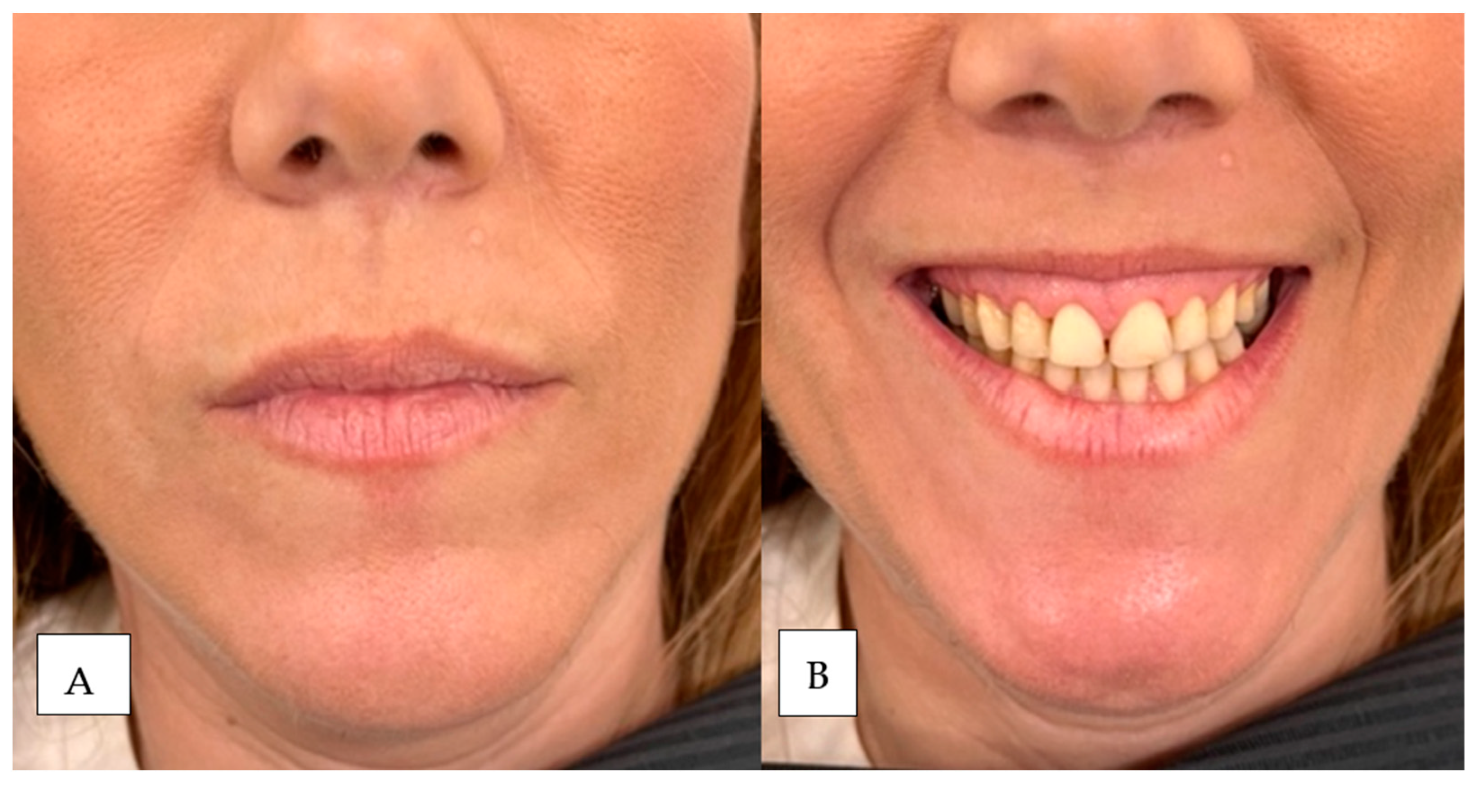 Dentistry 12 00319 g002