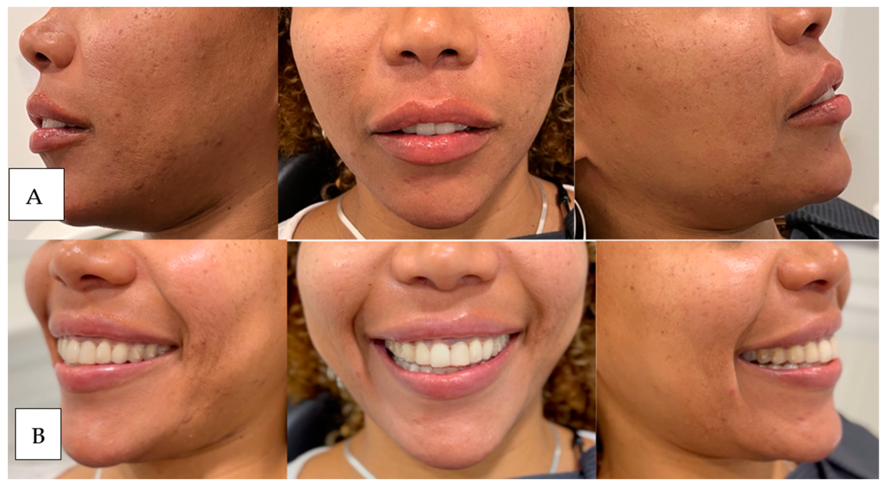 Dentistry 12 00319 g013