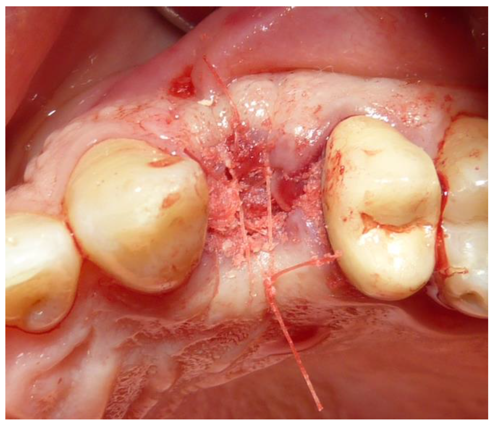 Dentistry 12 00320 g004