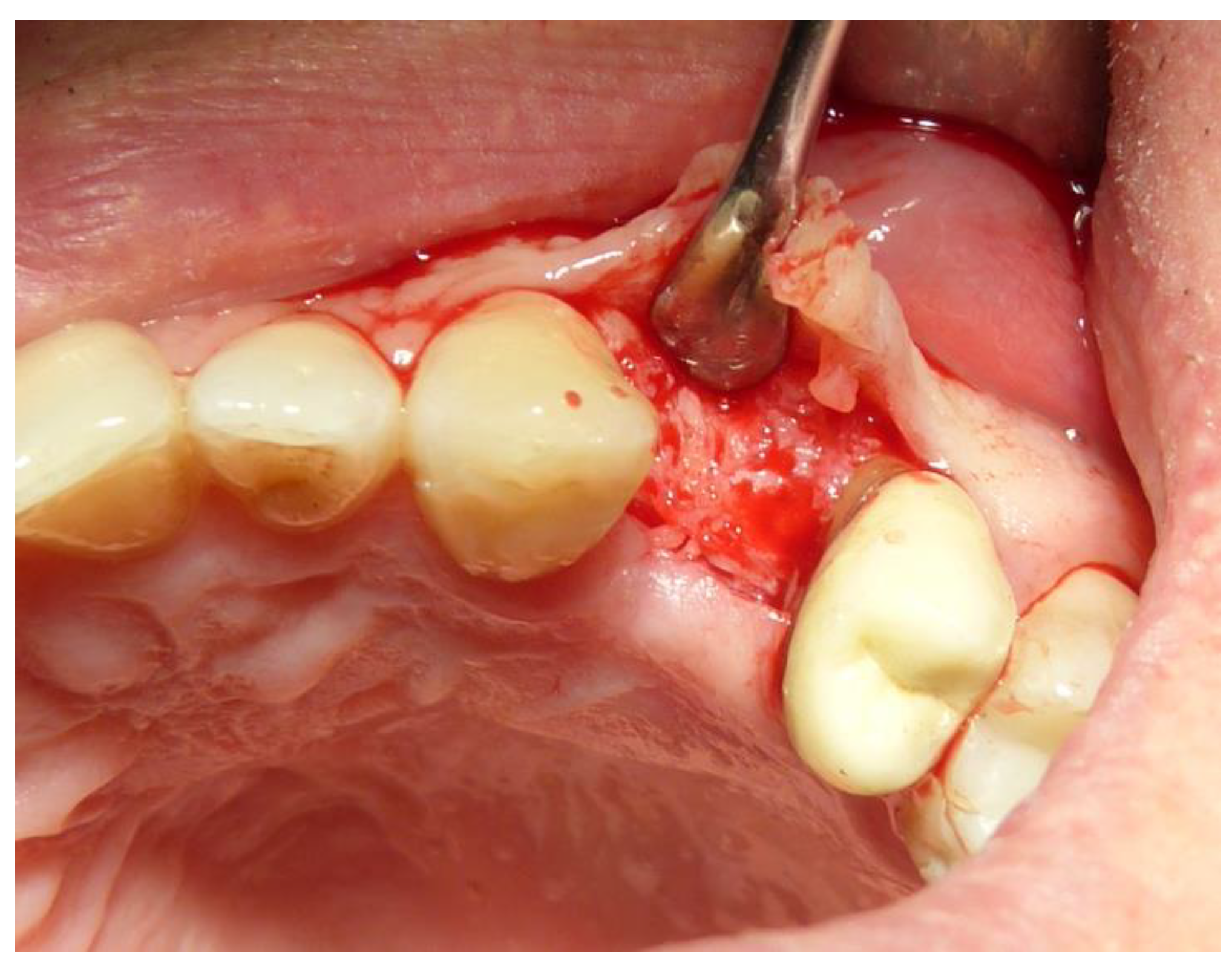 Dentistry 12 00320 g006