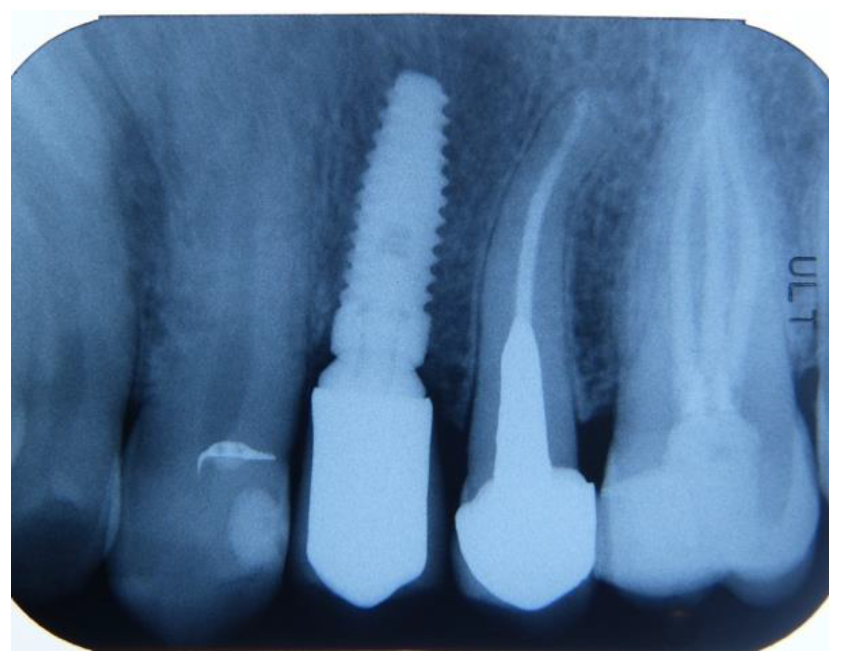Dentistry 12 00320 g008