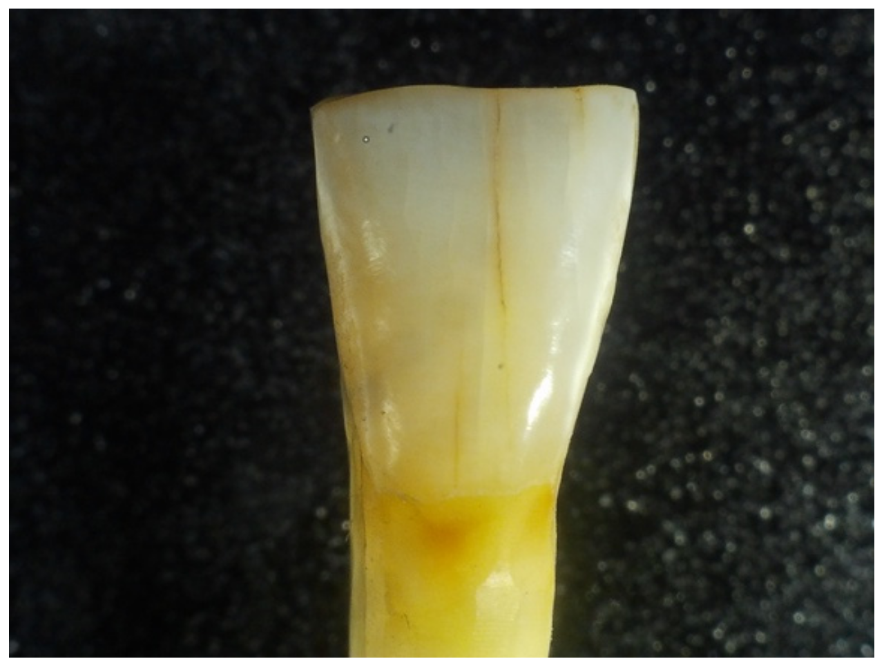 Dentistry 12 00332 g003