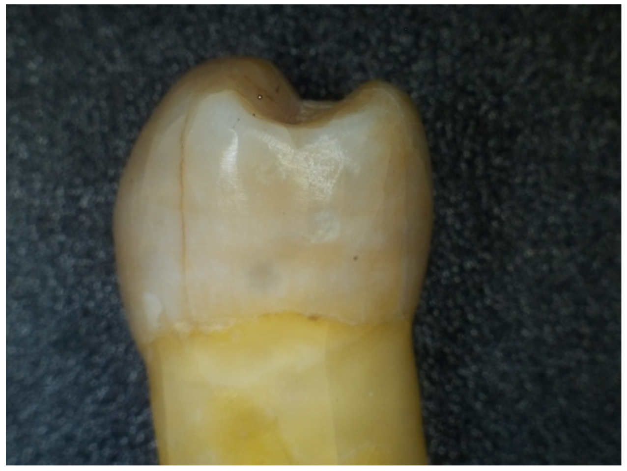 Dentistry 12 00332 g004