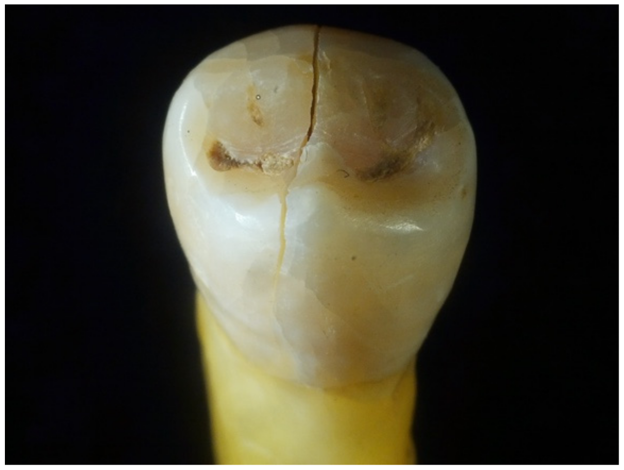 Dentistry 12 00332 g006