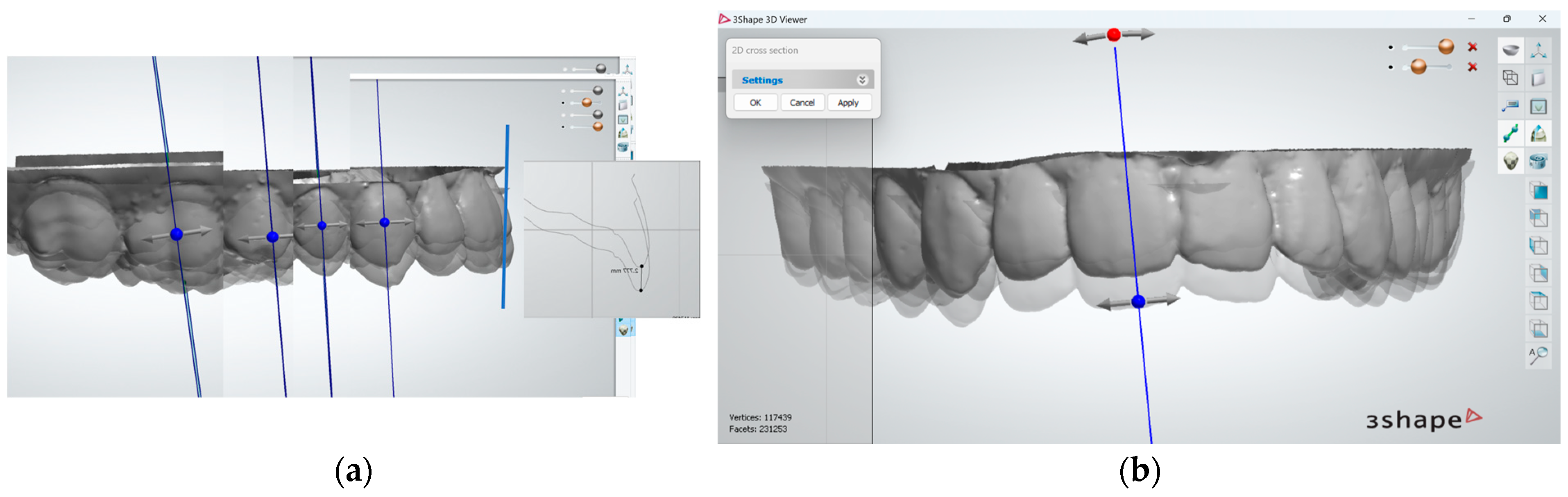 Dentistry 12 00336 g006