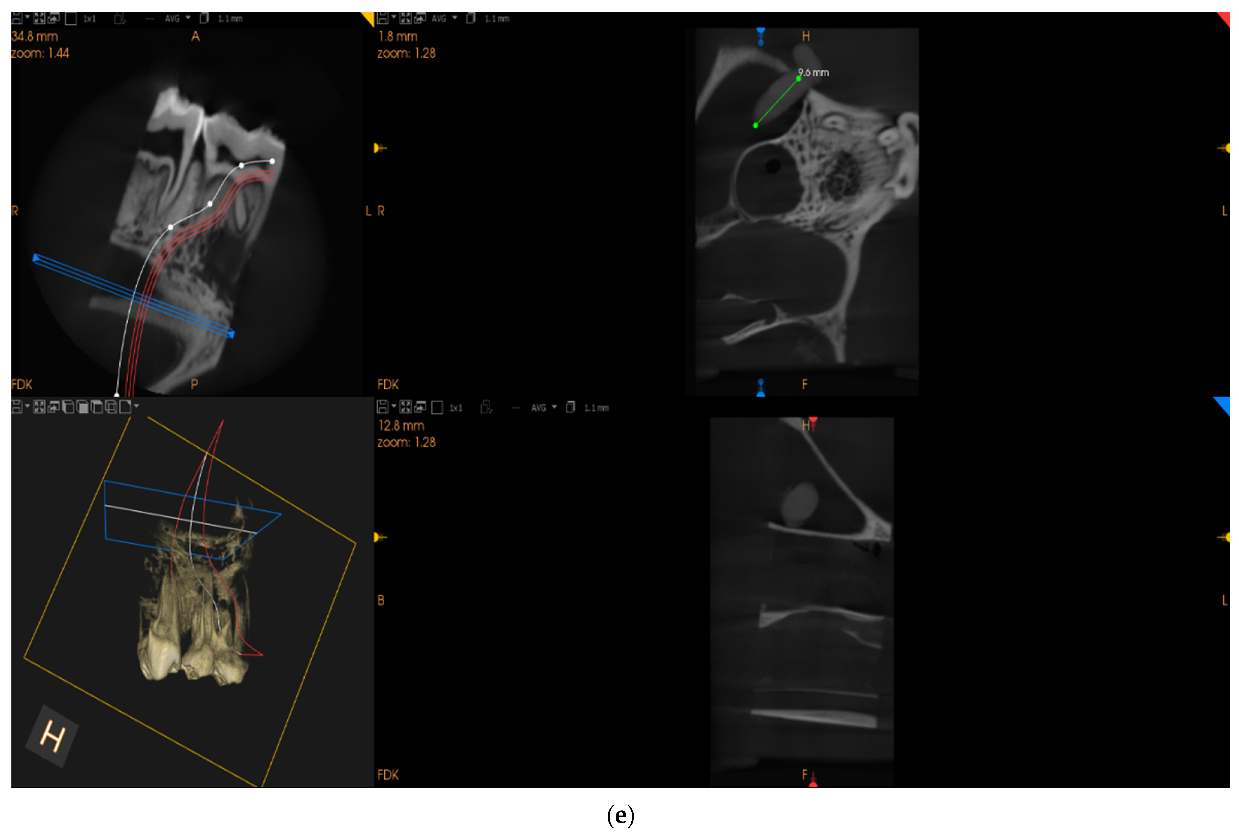 Dentistry 12 00337 g001c