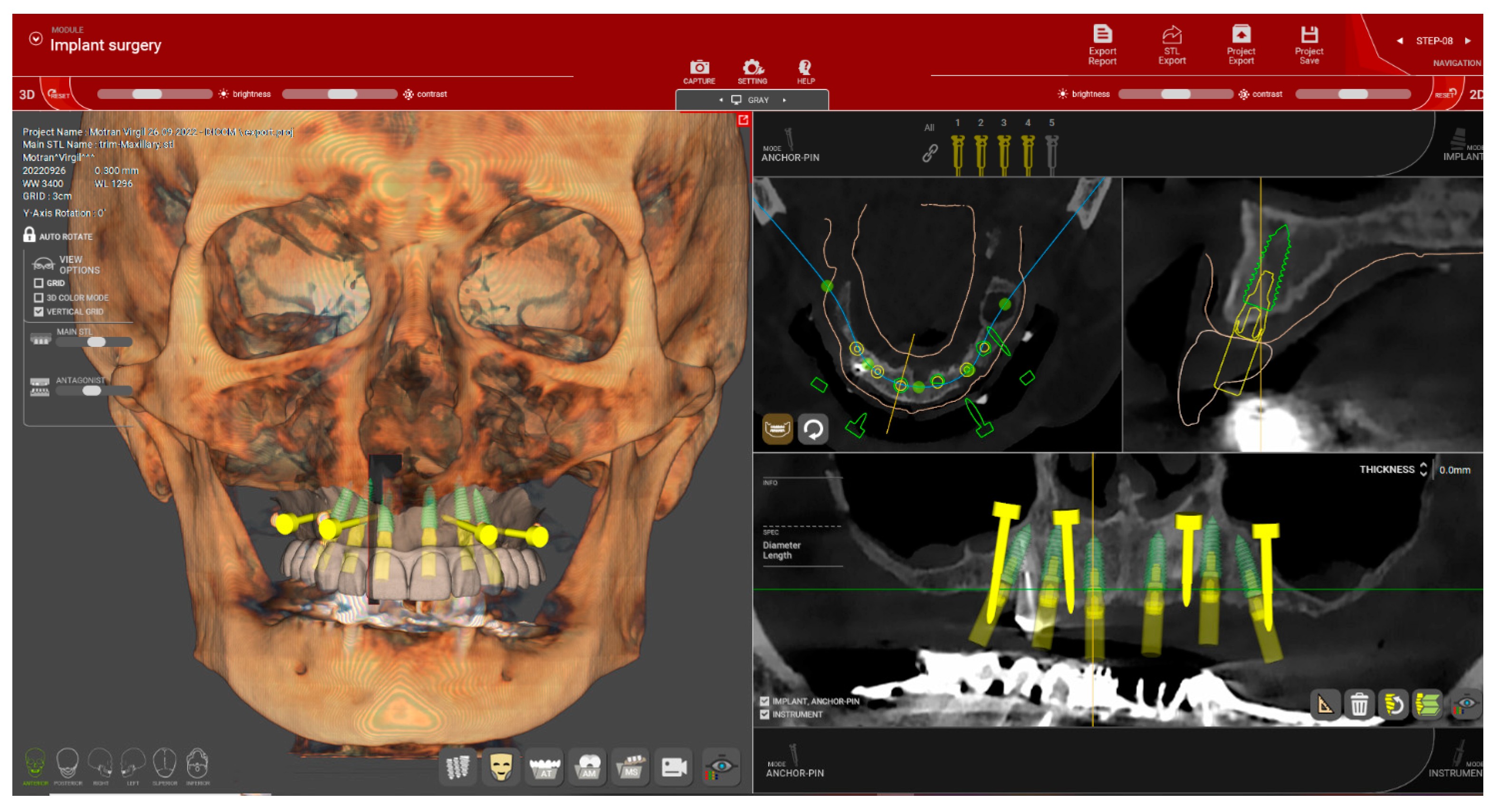 Dentistry 12 00347 g009