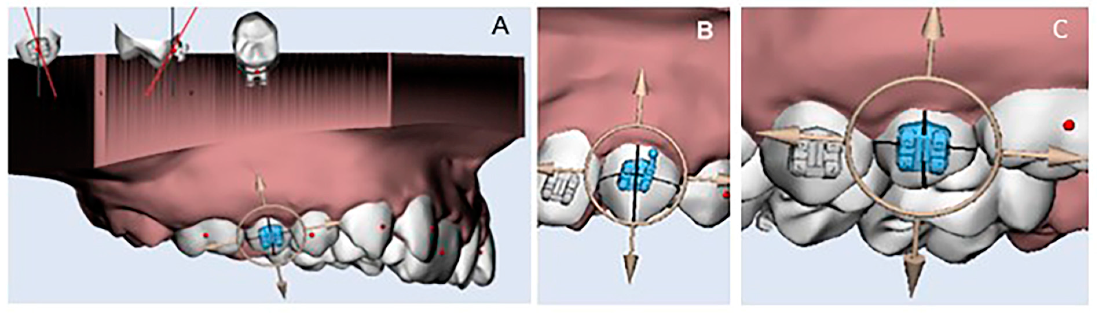 Dentistry 12 00352 g001