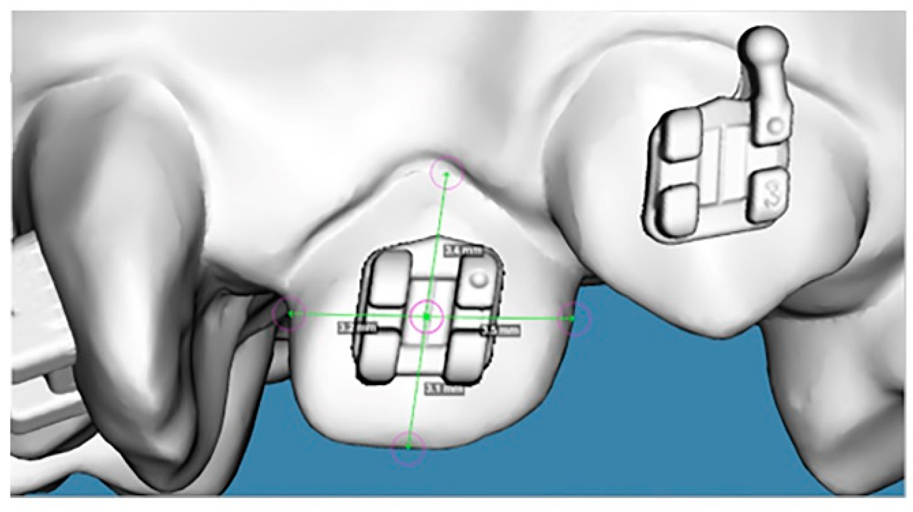 Dentistry 12 00352 g005