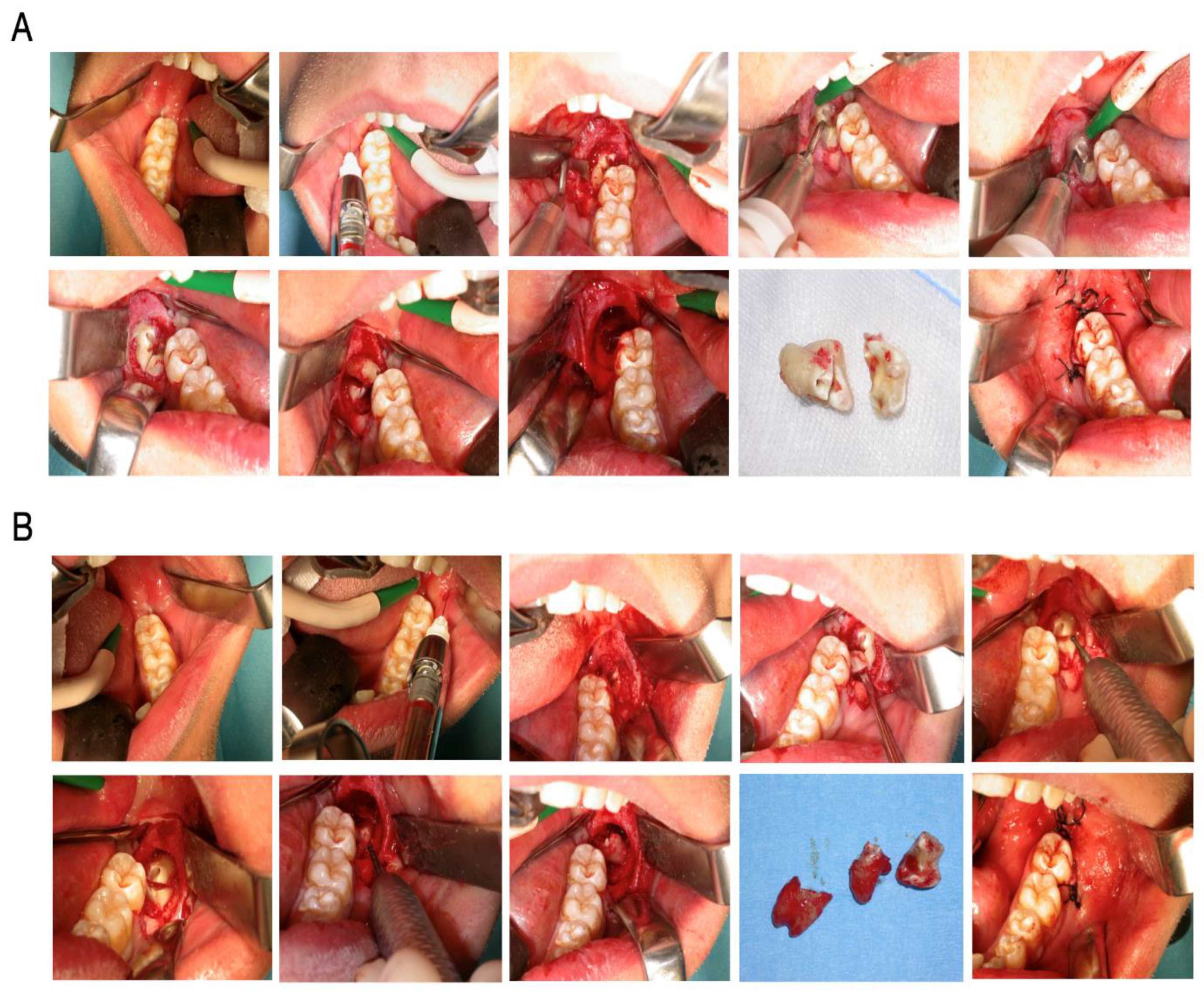 Dentistry 12 00353 g002