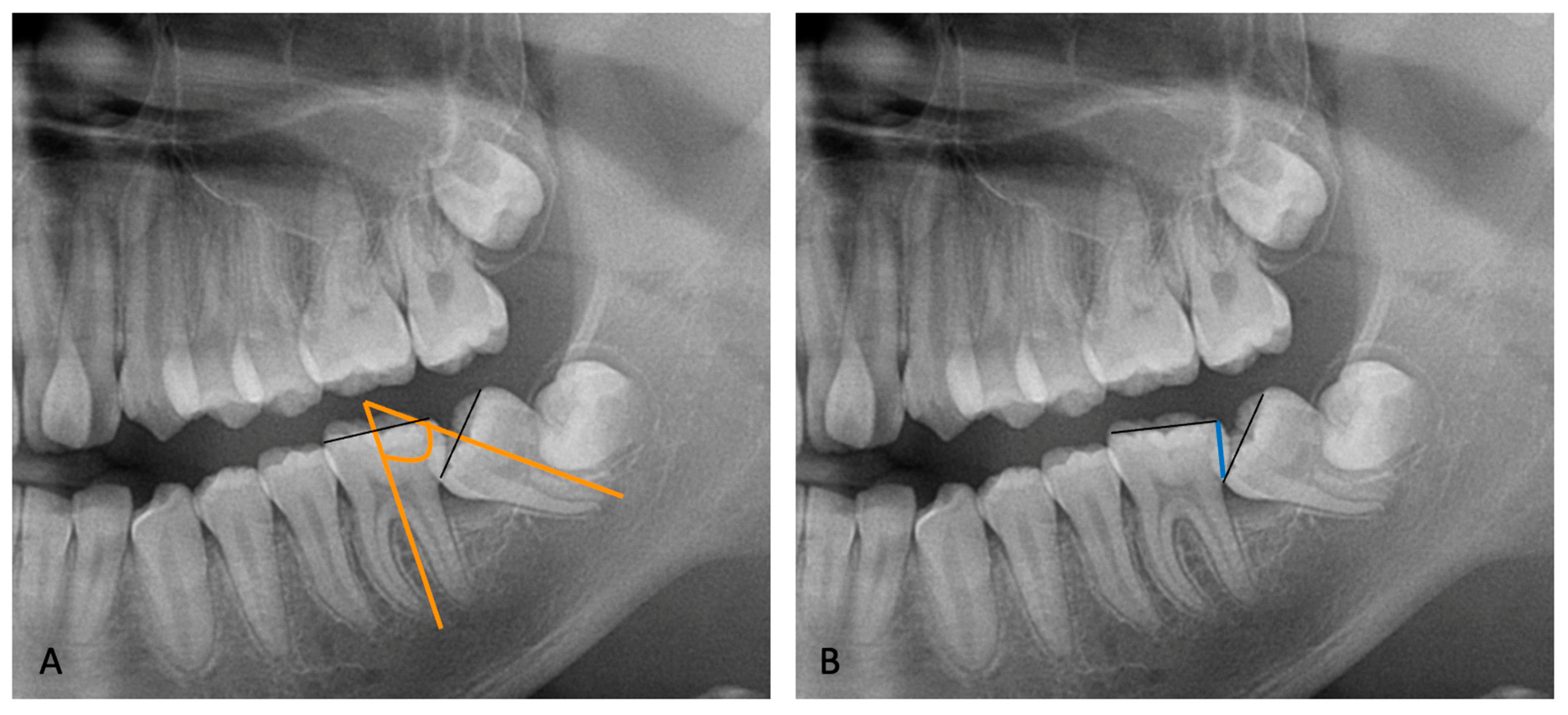 Dentistry 12 00359 g001