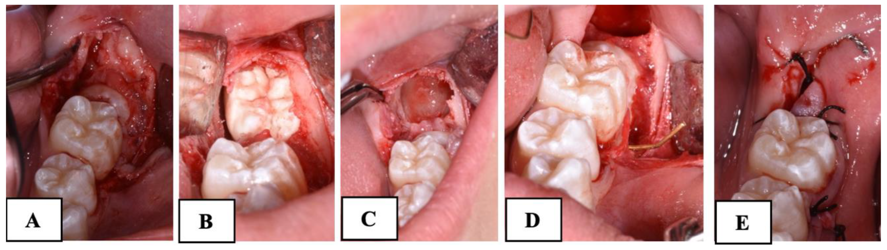 Dentistry 12 00359 g002
