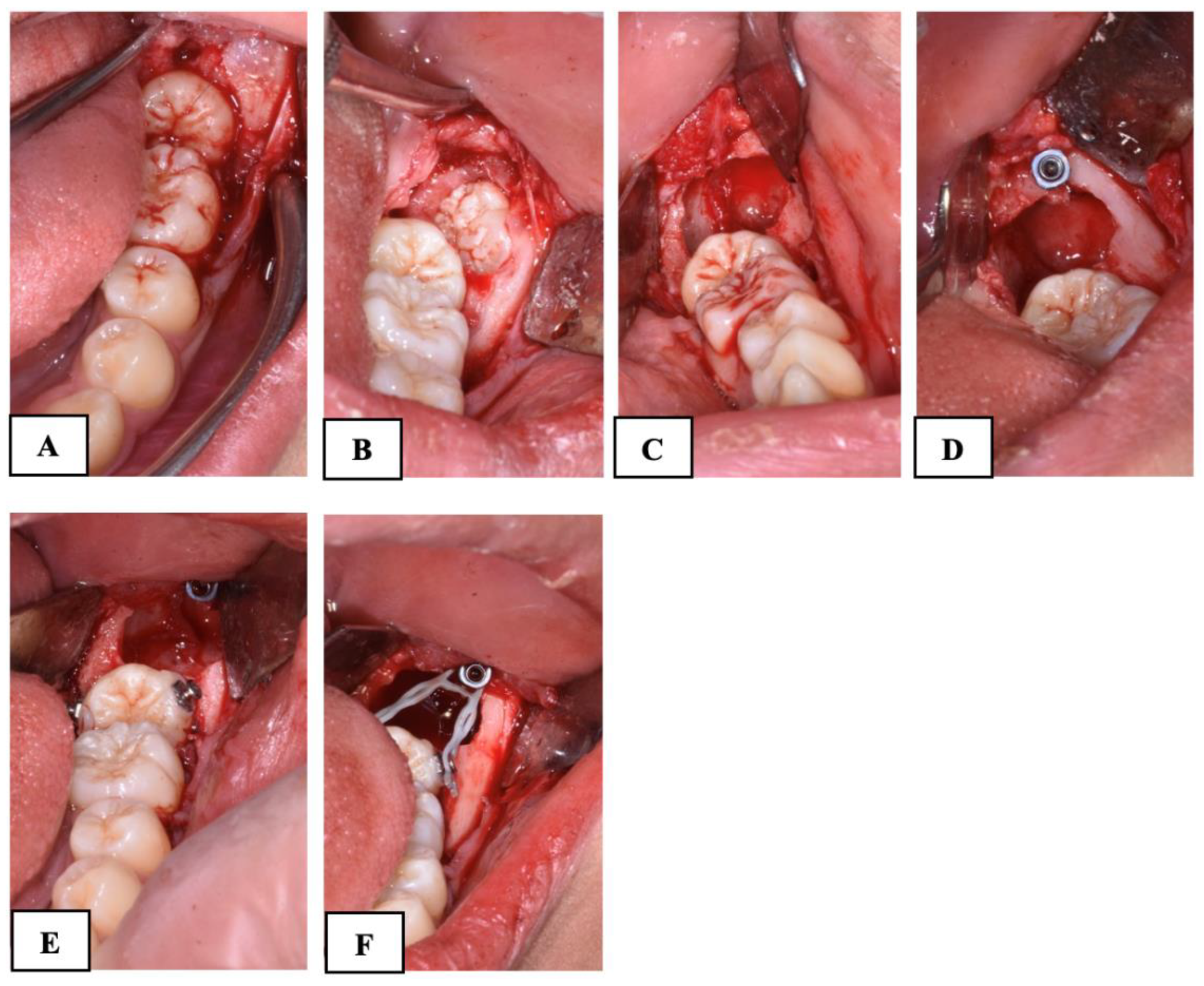 Dentistry 12 00359 g003