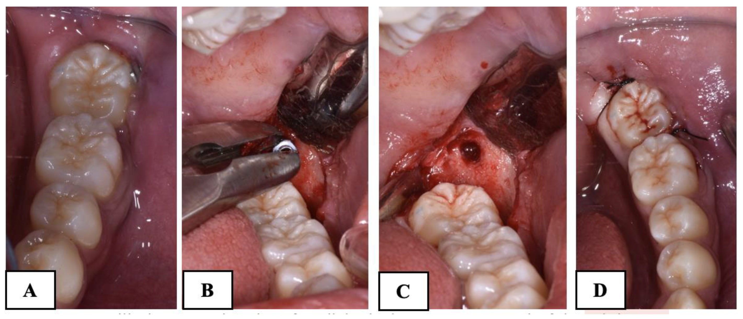 Dentistry 12 00359 g005