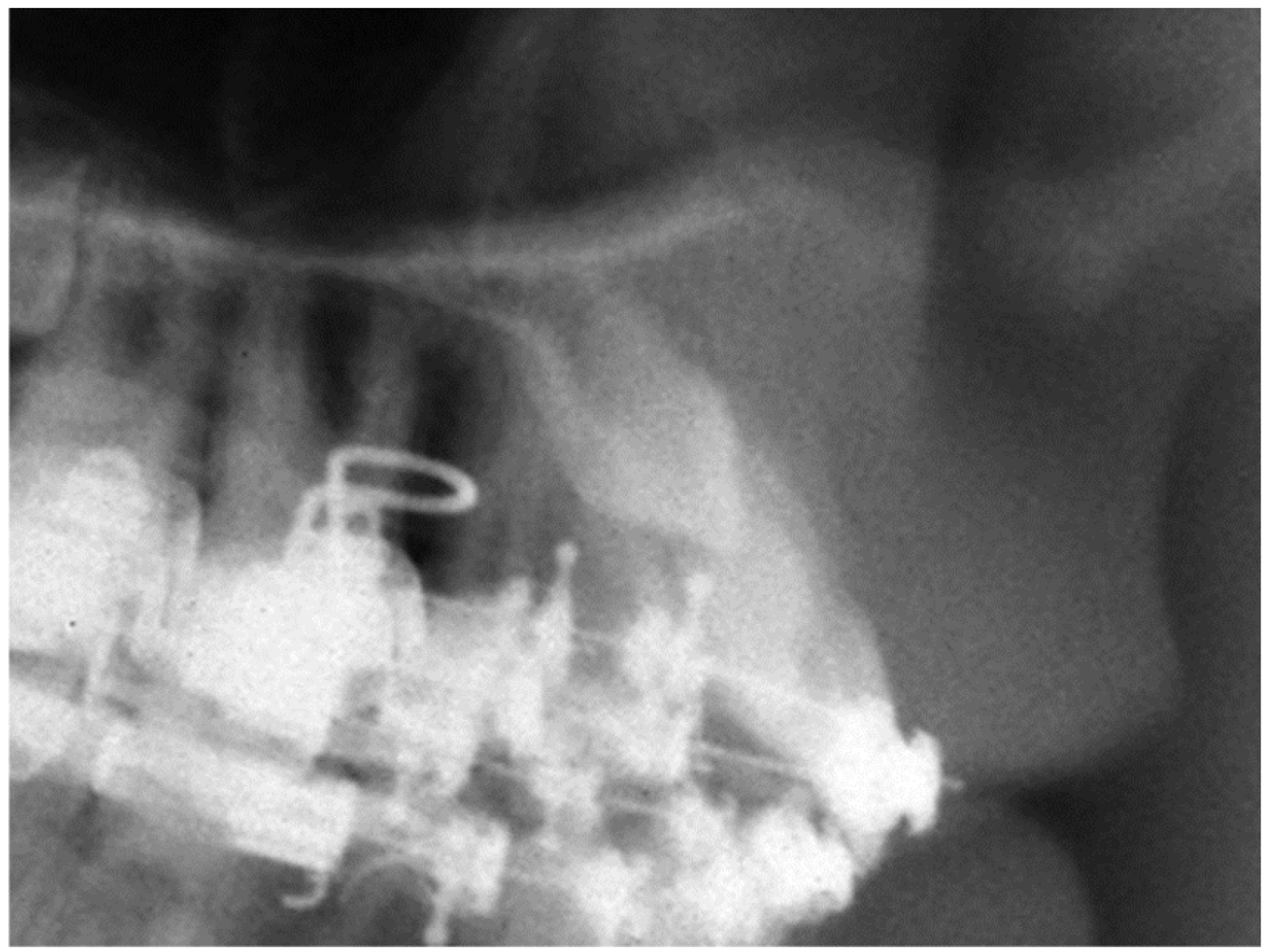 Dentistry 12 00360 g007