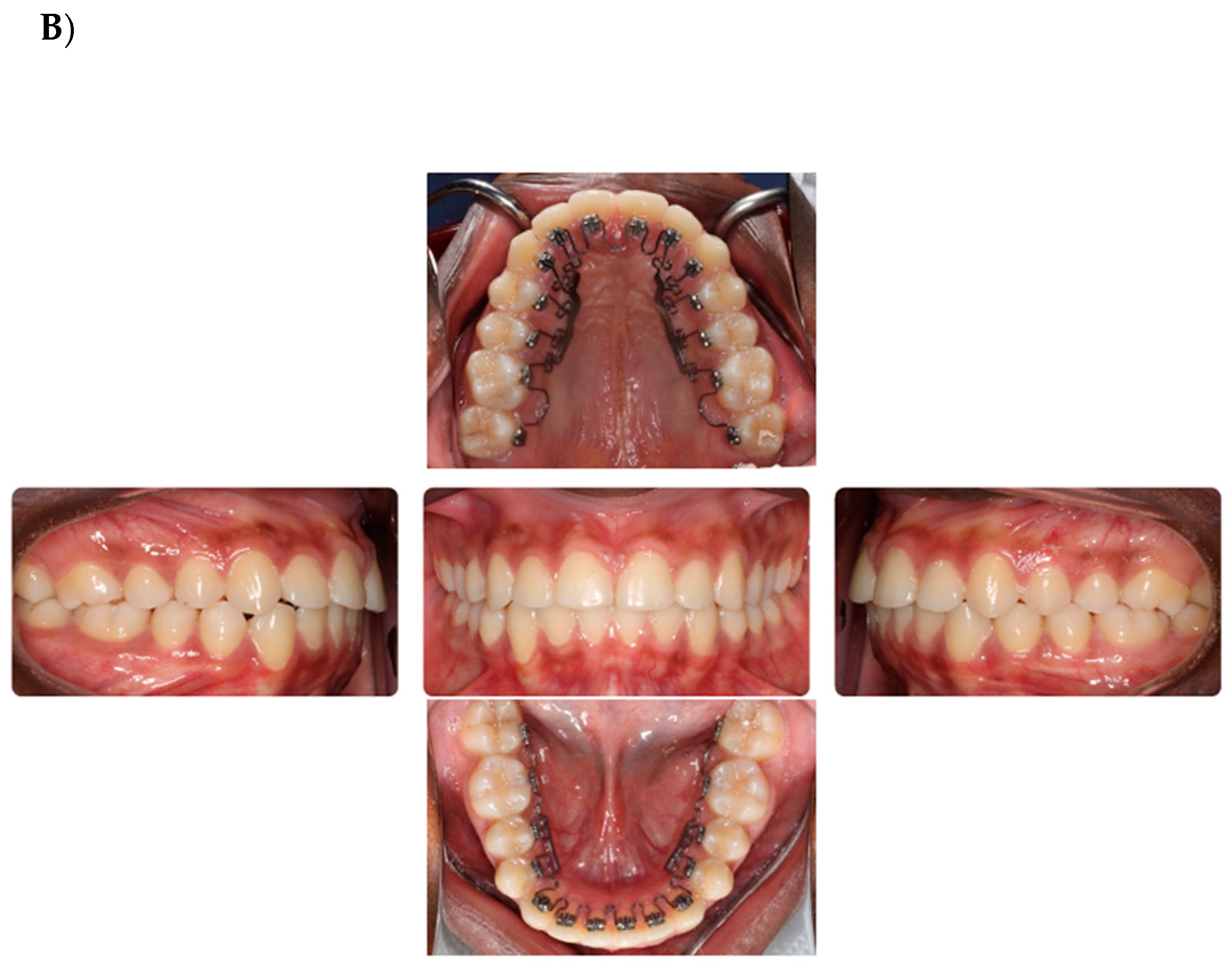 Dentistry 12 00368 g001b