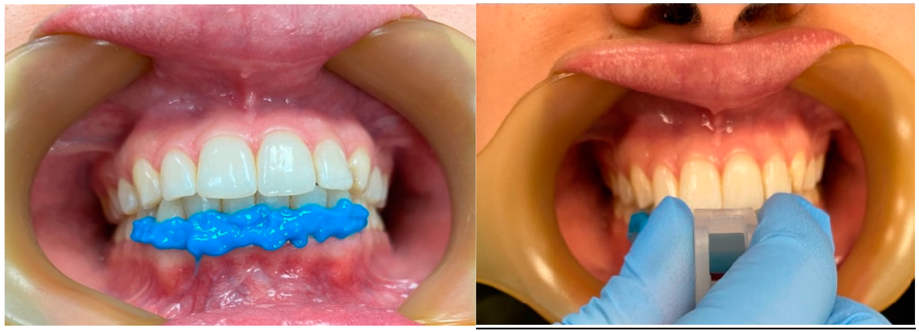 Dentistry 12 00369 g002