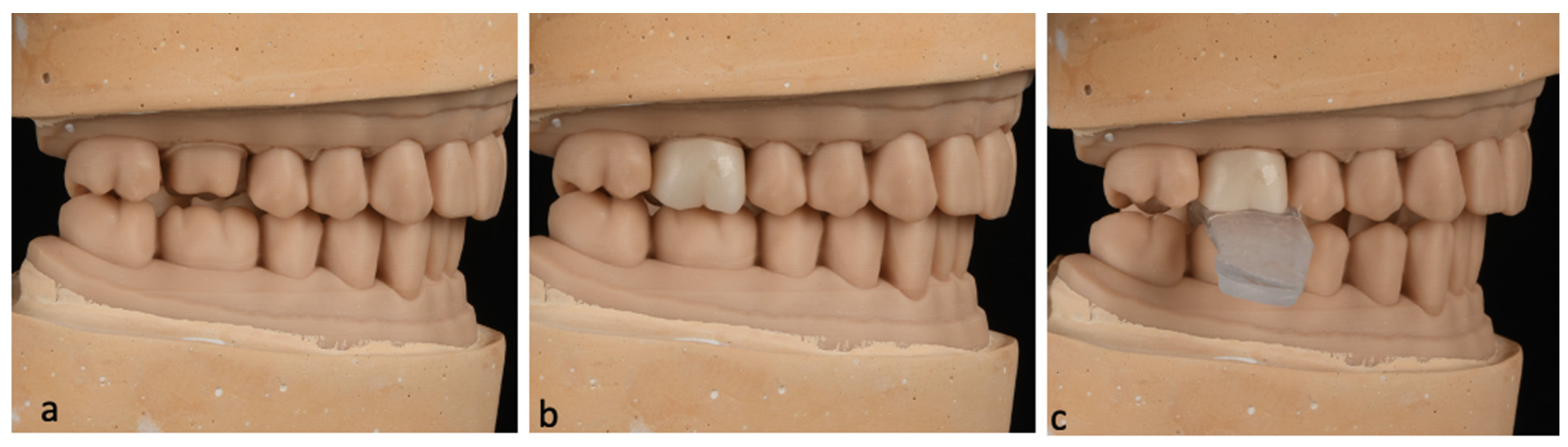 Dentistry 12 00377 g001