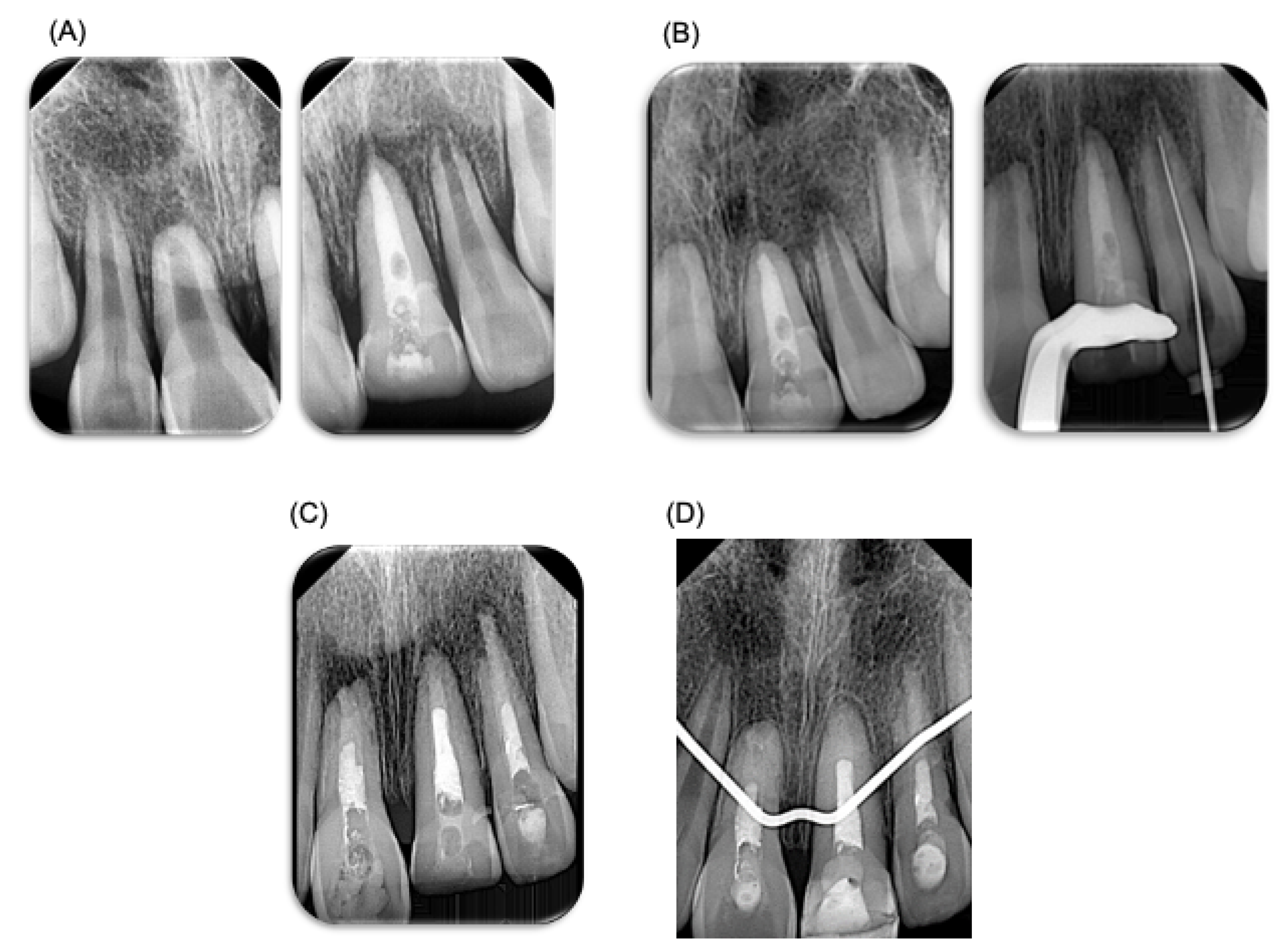 Dentistry 12 00380 g003