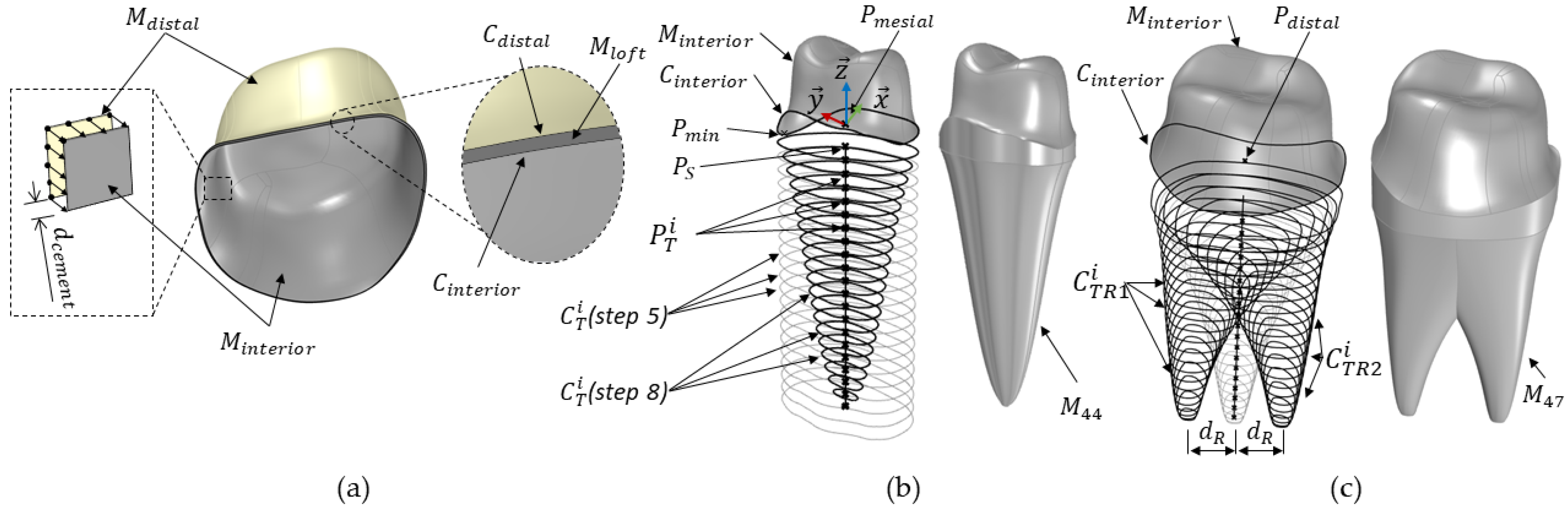 Automated Support Generation for Fixed Partial Dentures and Impact of ...