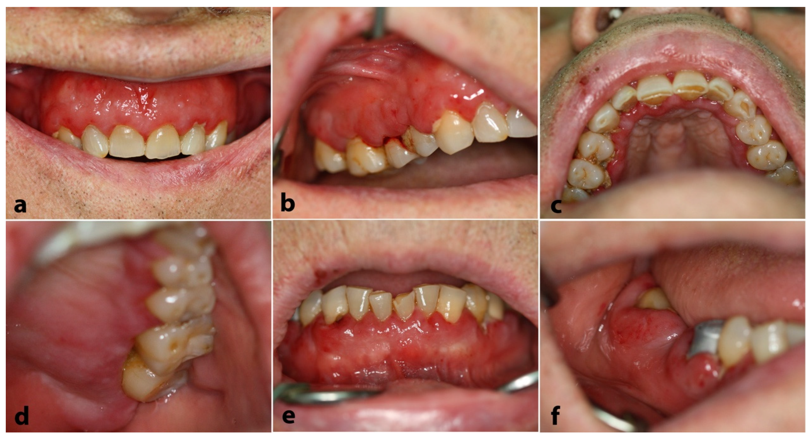 Dentistry 12 00403 g001