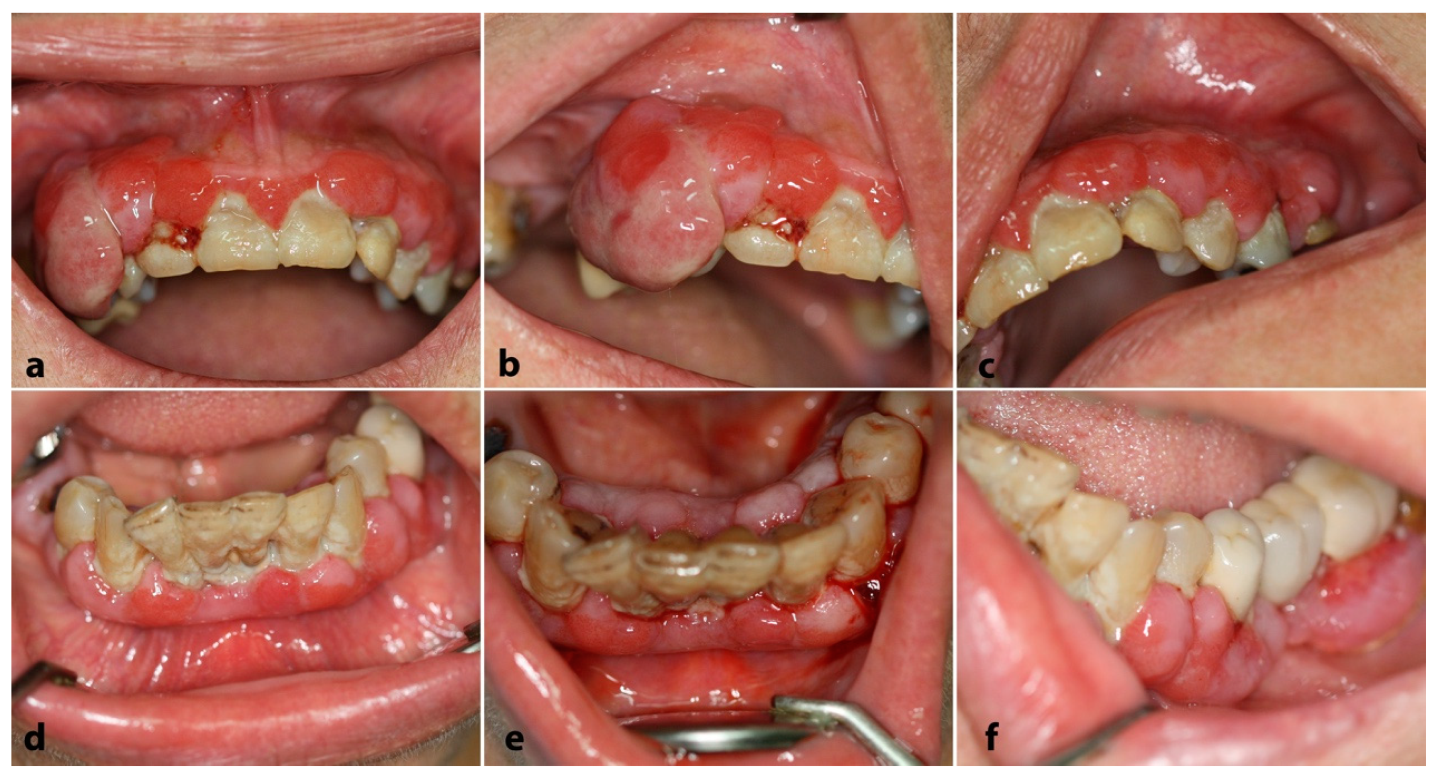Dentistry 12 00403 g003