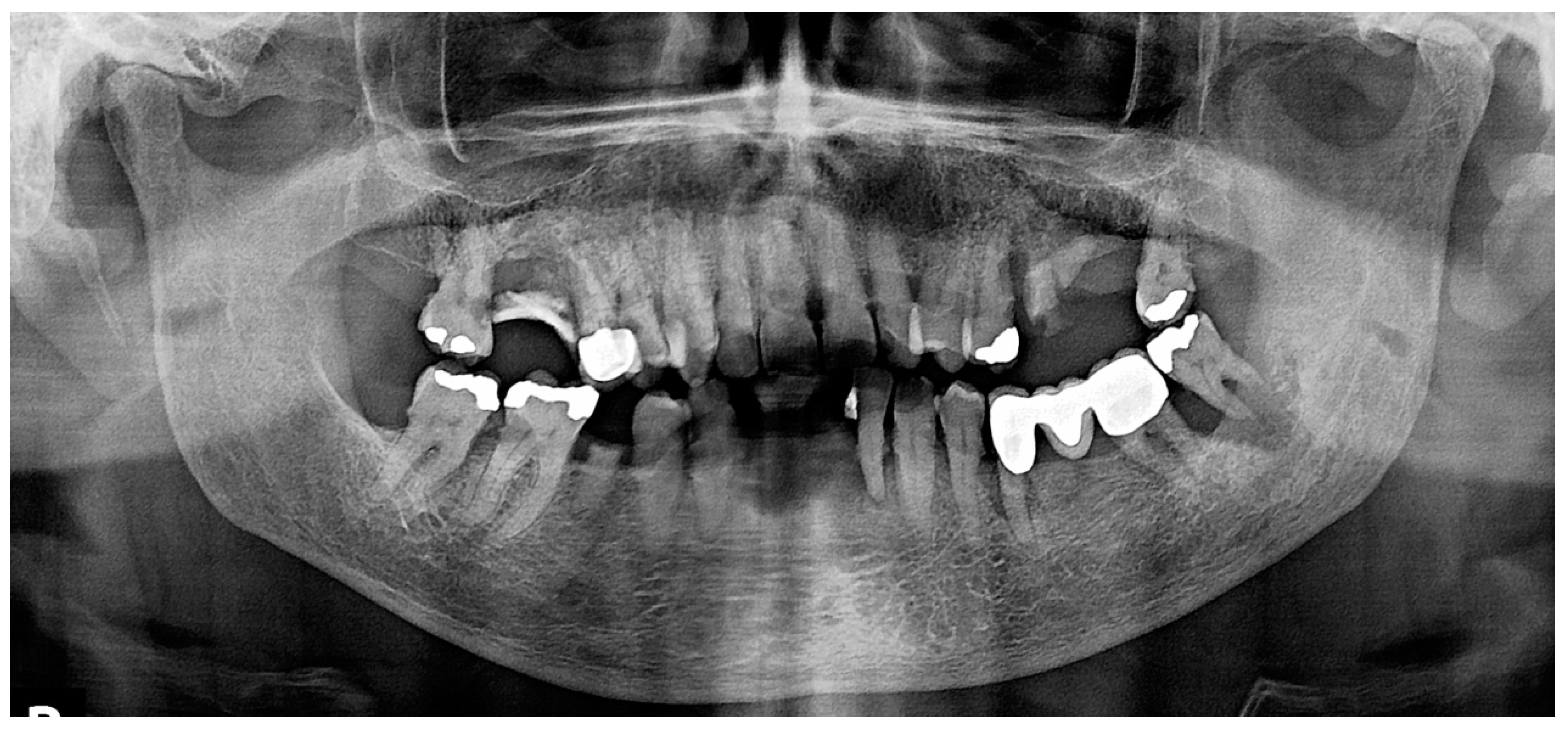 Dentistry 12 00403 g004