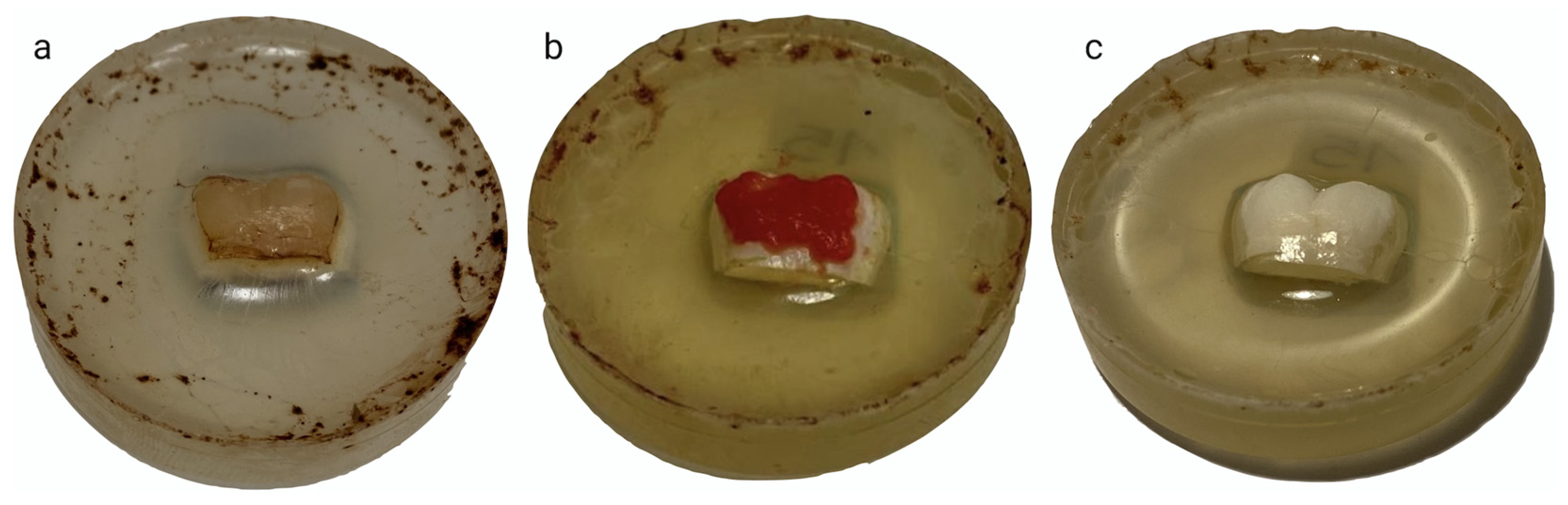 Dentistry 12 00415 g002 Dentistry 12 00415 g002