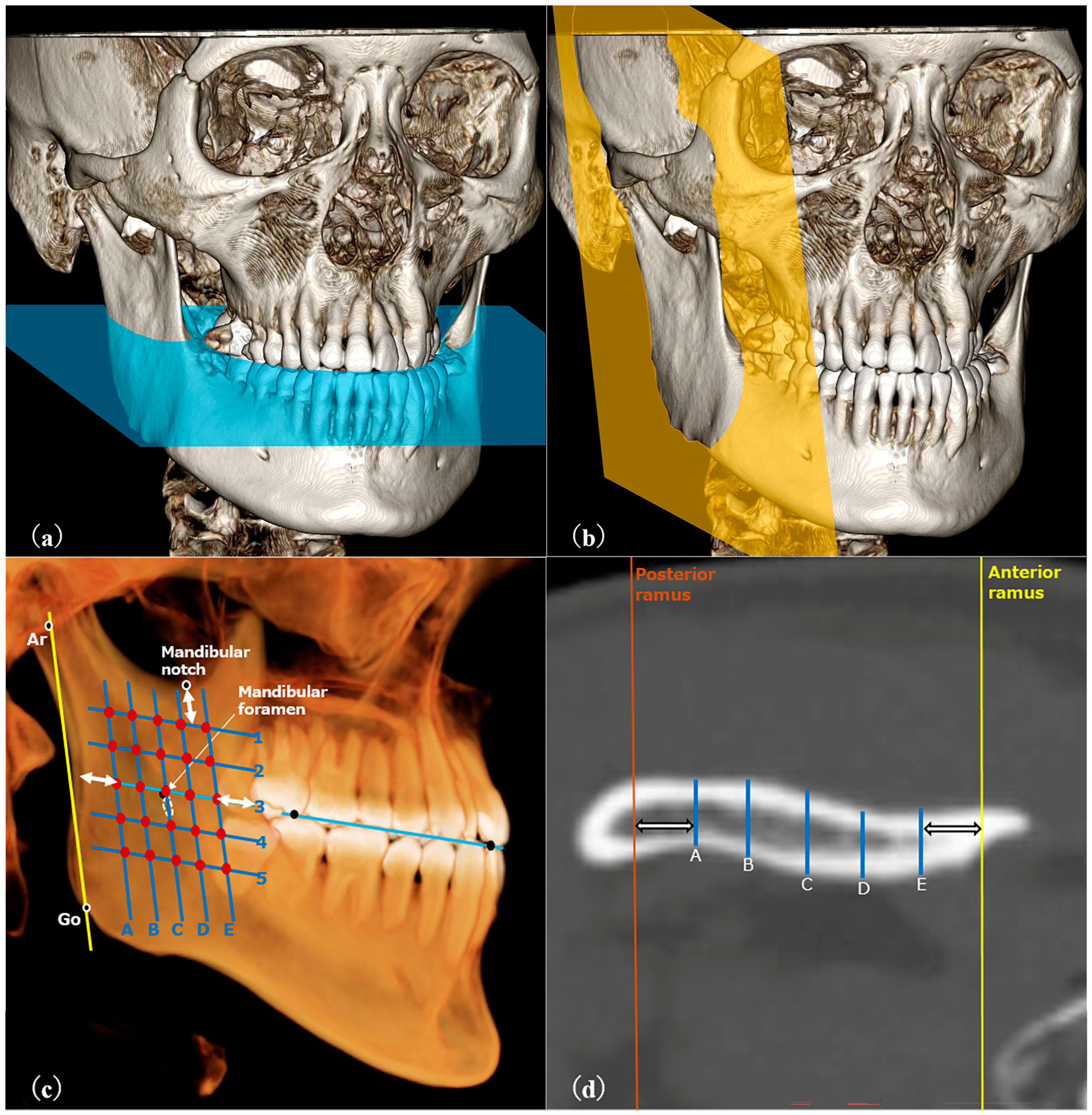Dentistry 13 00003 g002