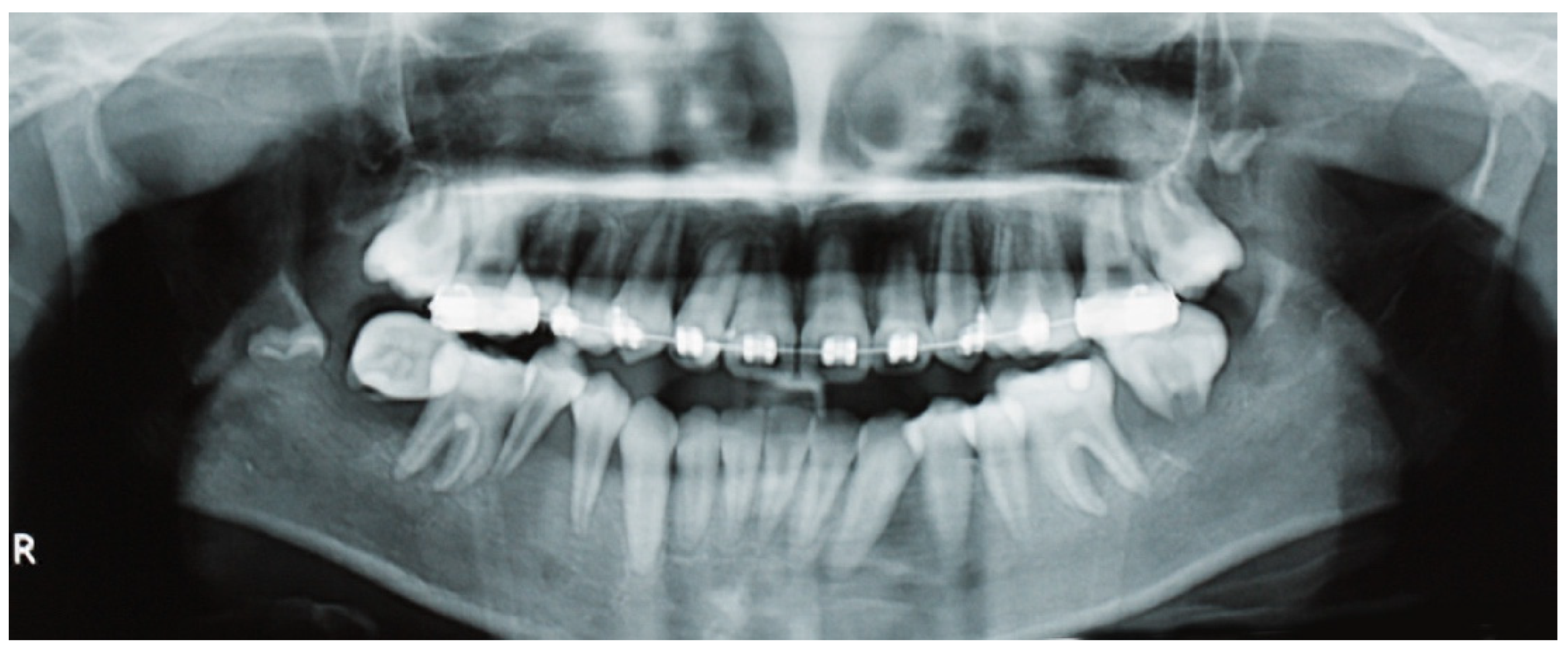 Dentistry 13 00006 g002