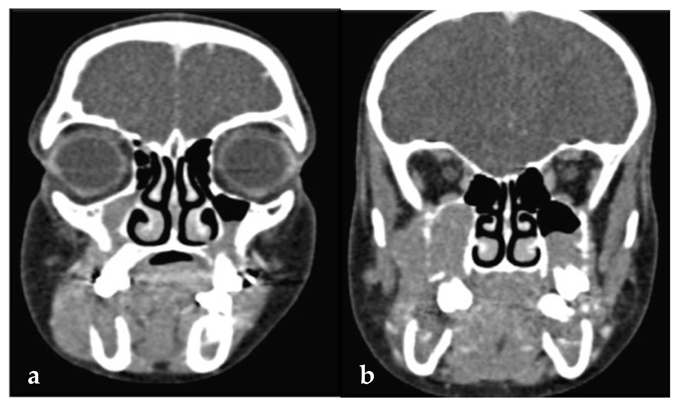 Dentistry 13 00006 g003