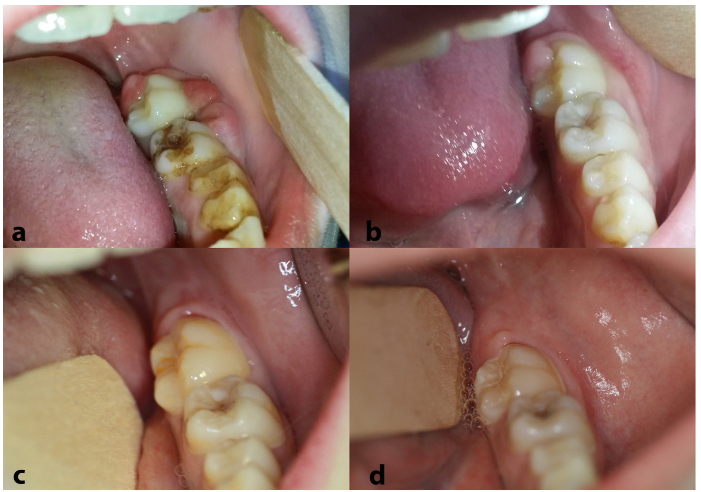 Dentistry 13 00006 g007