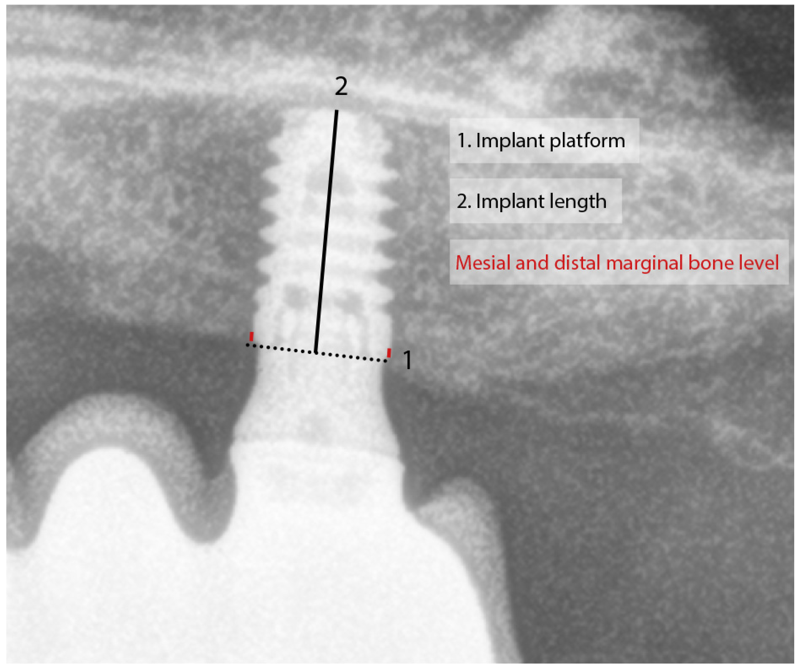 Dentistry 13 00012 g001 Dentistry 13 00012 g001