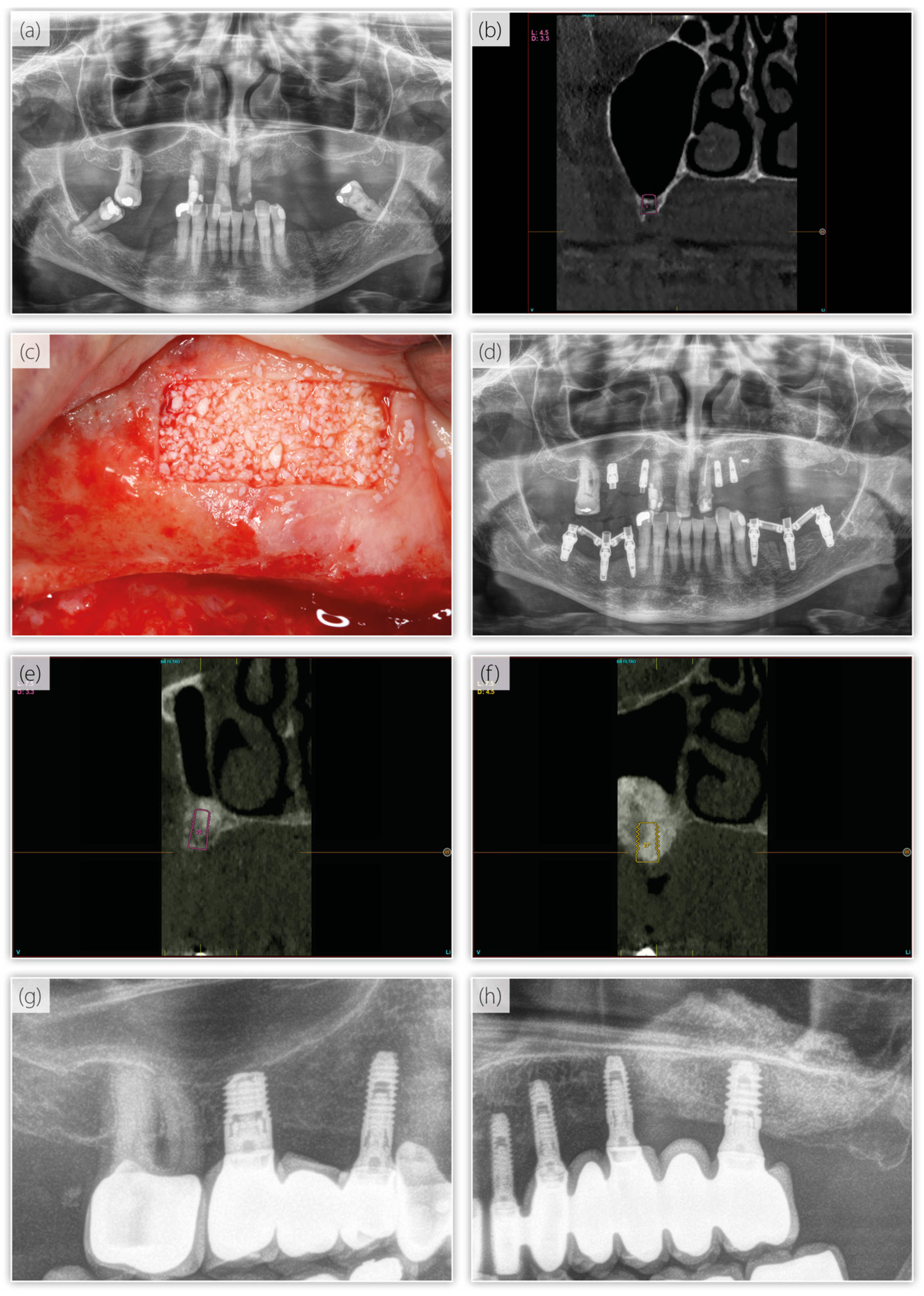 Dentistry 13 00012 g005 Dentistry 13 00012 g005