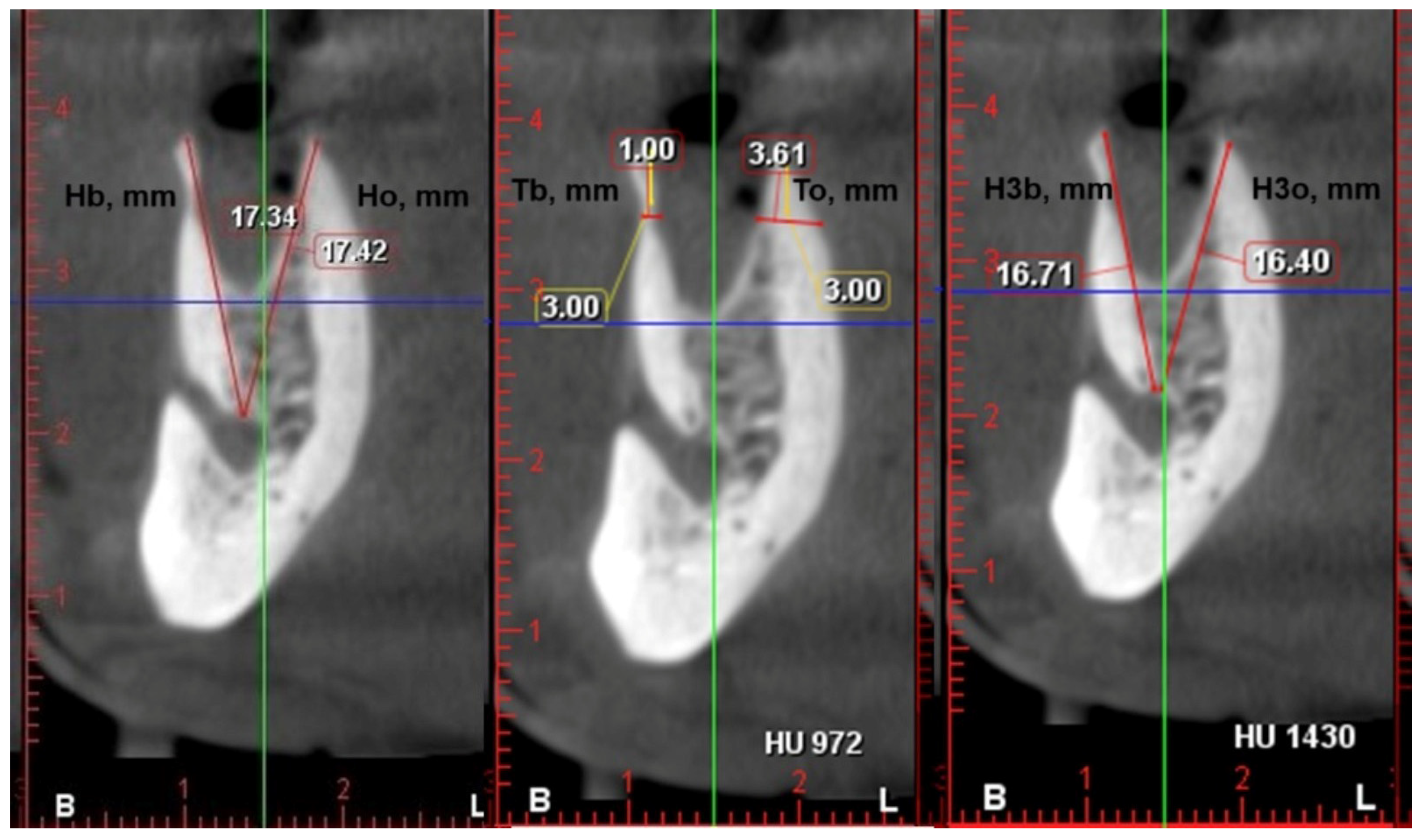 Dentistry 13 00024 g002