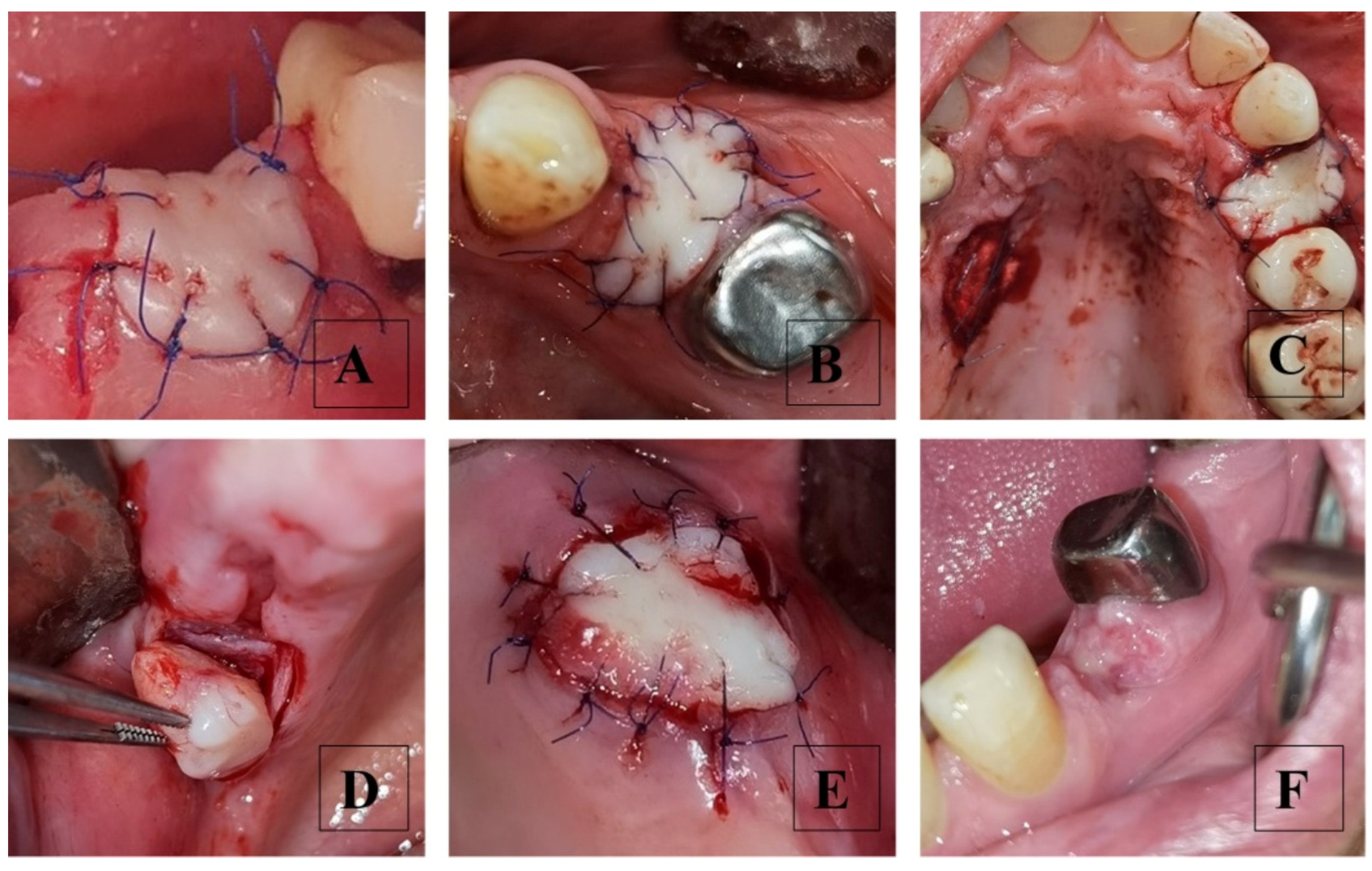Dentistry 13 00024 g003