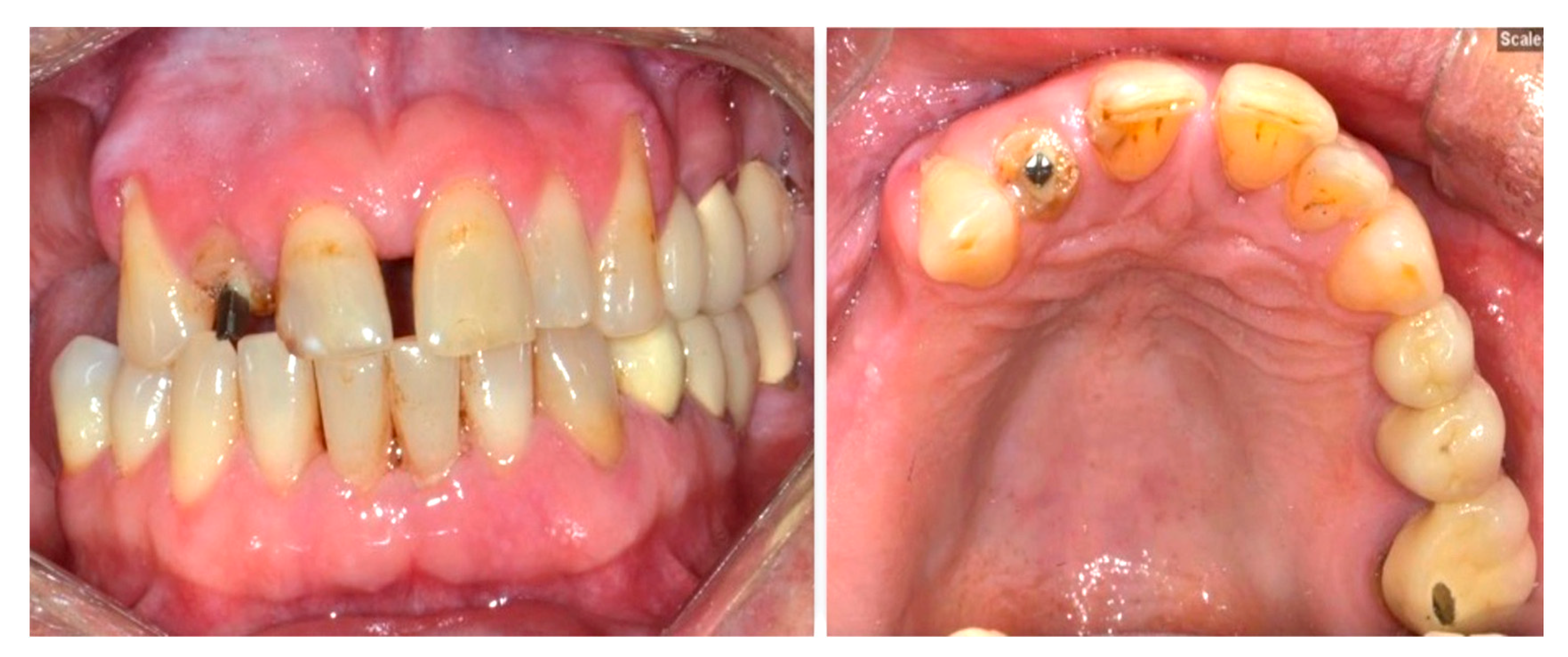 Dentistry 13 00042 g002