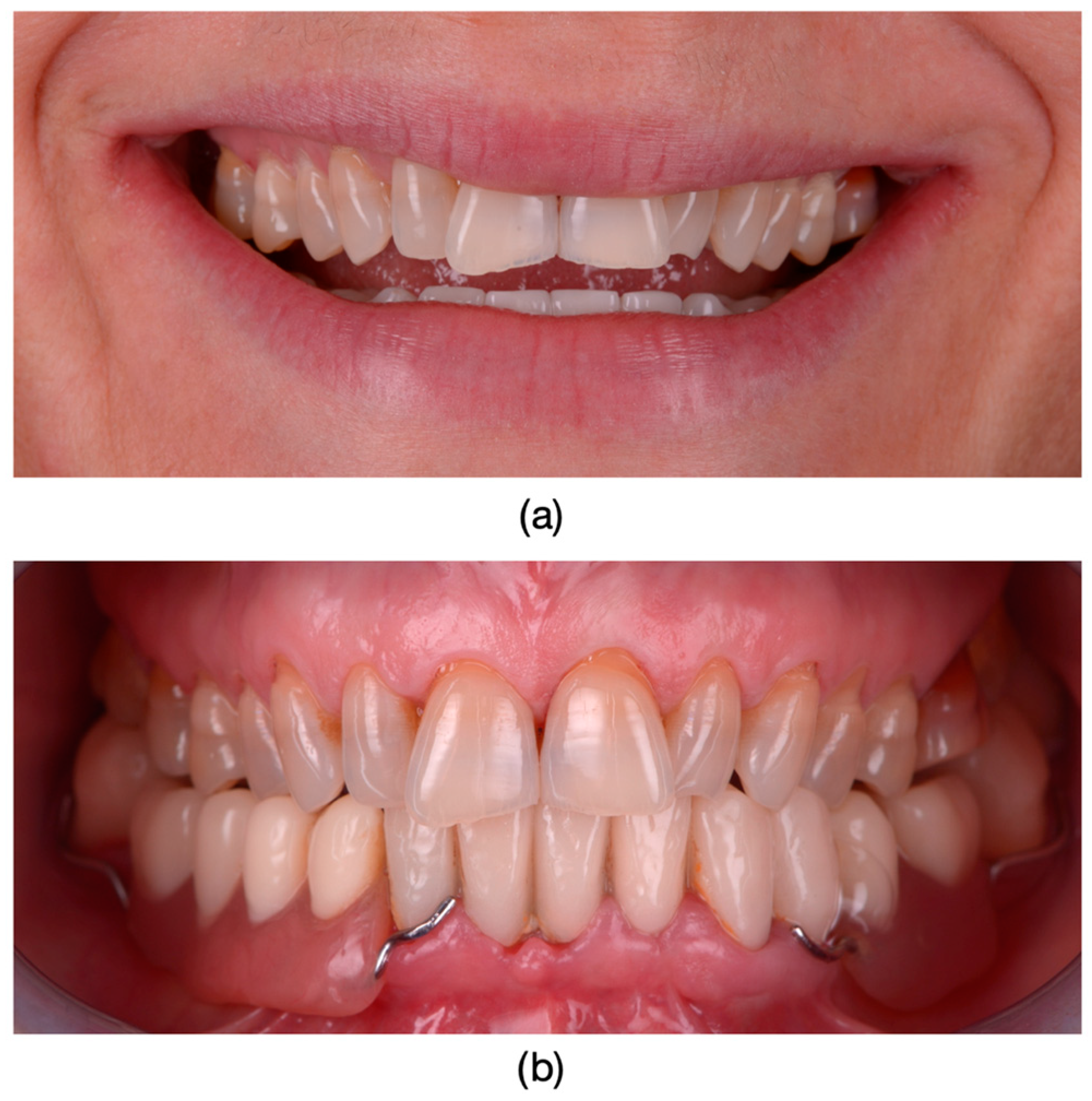 Dentistry 13 00044 g001