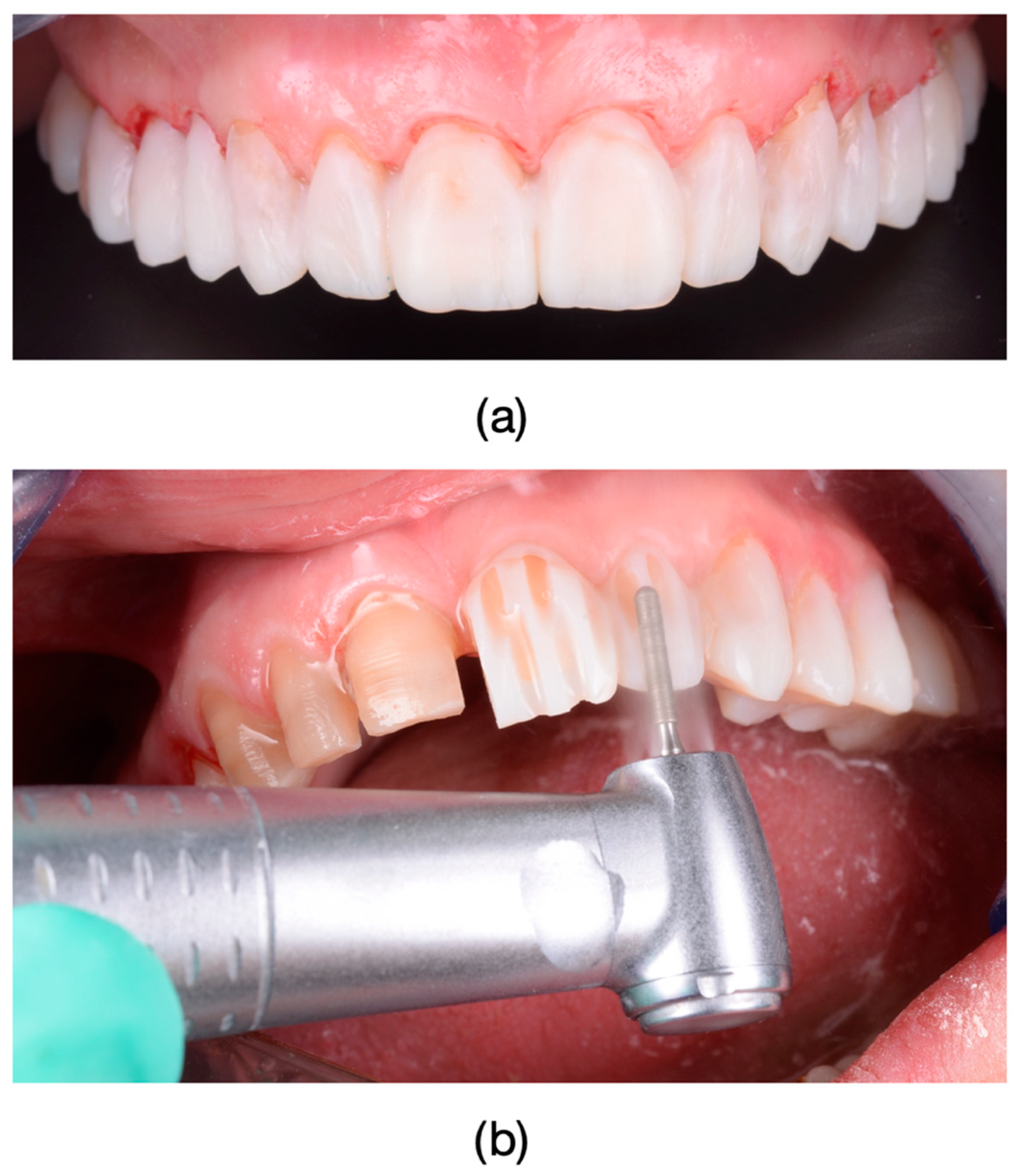 Dentistry 13 00044 g004